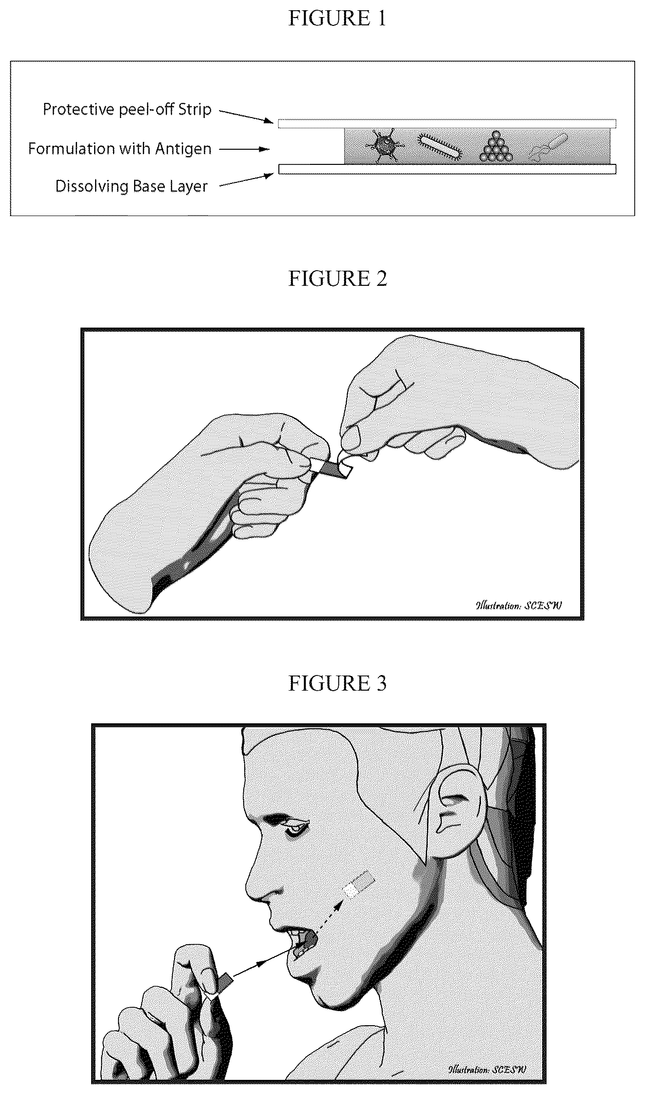 Patent US12472145 Figure 1 – Methods for inducing an immune response via buccal and/or sublingual administration of a vaccine
