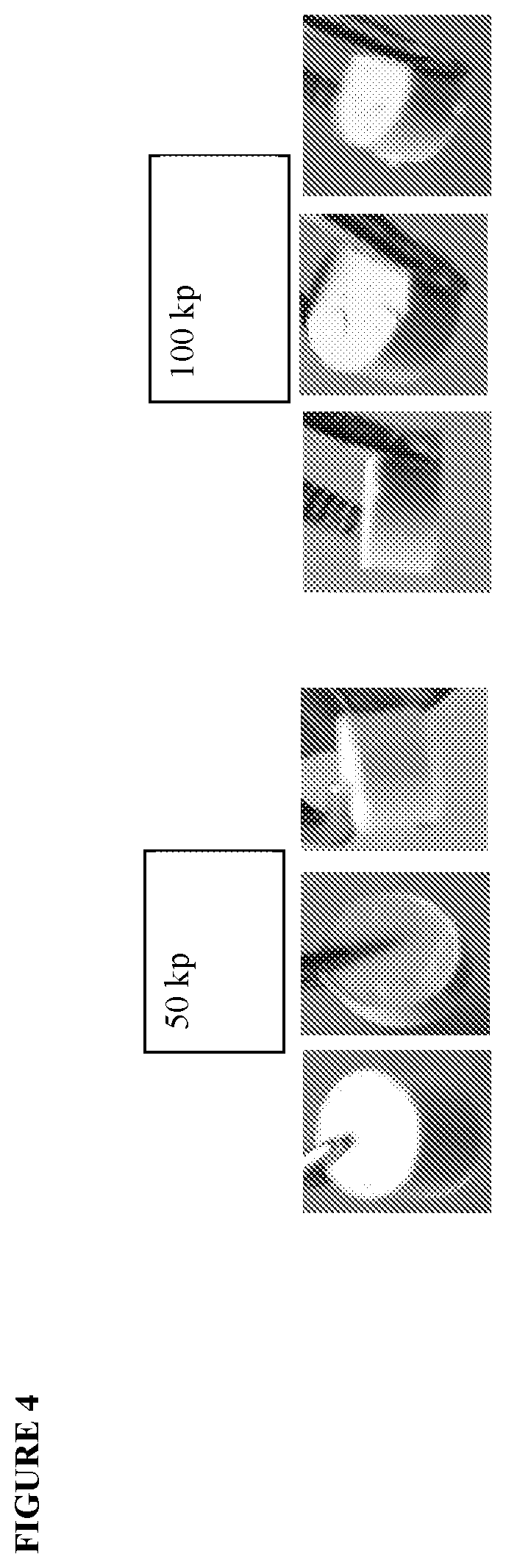 Patent US12472147 Figure 16 – Intestinal alkaline phosphatase formulations