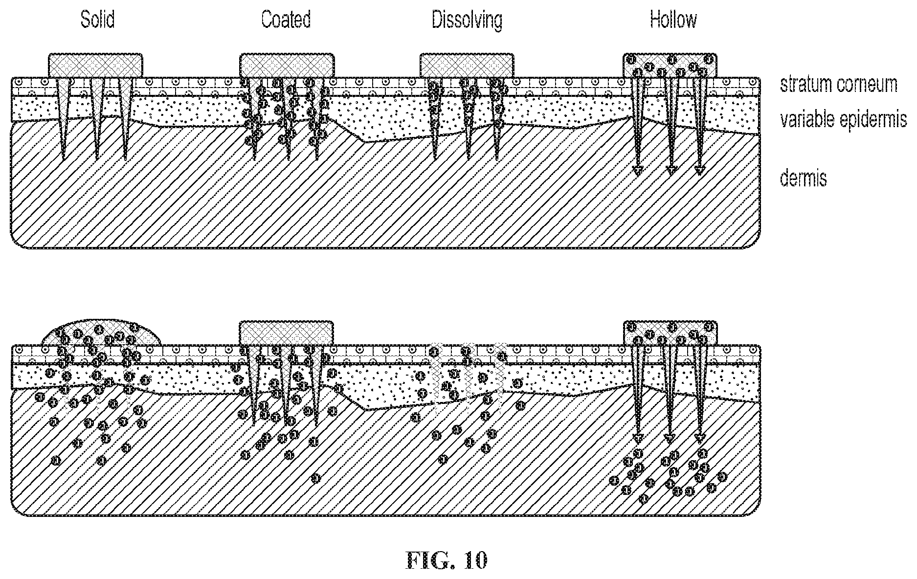 Patent US12472160 Figure 10 – Modified-release tiopronin compositions, kits and methods for treating cystinuria and related disorders
