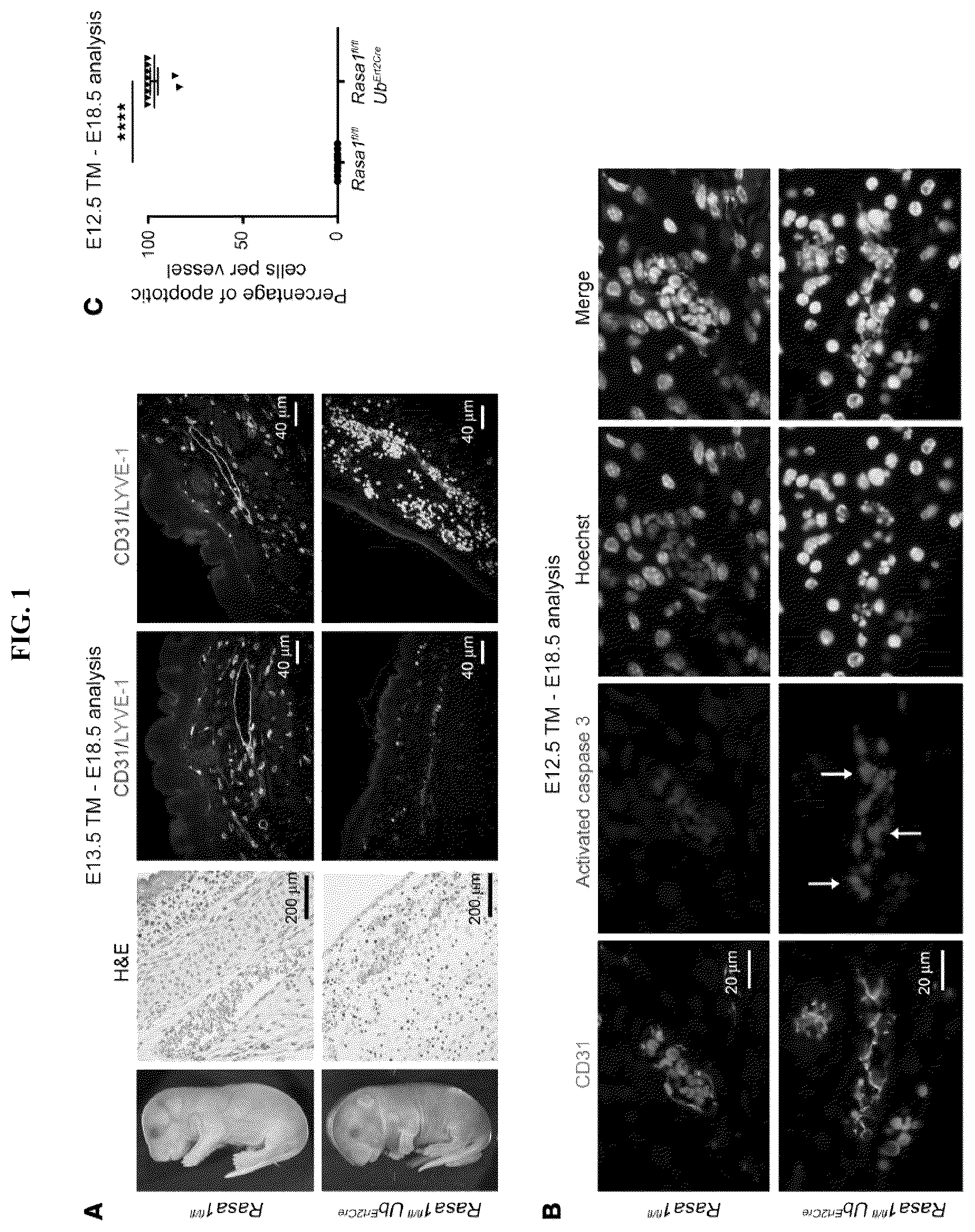 Patent US12472189 Figure 1 – Treatment and prevention of capillary malformation-arteriovenous malformation