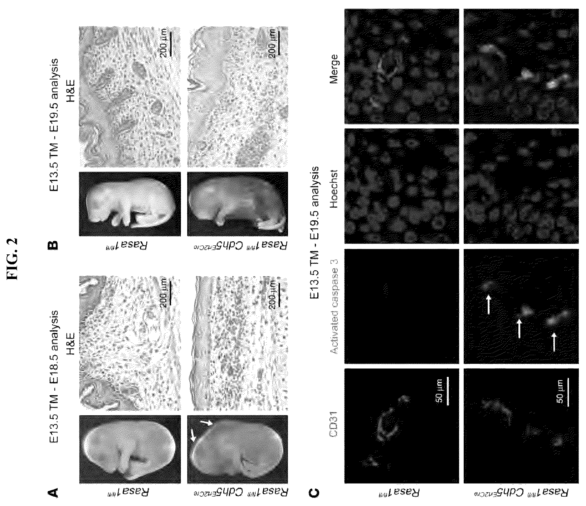 Patent US12472189 Figure 2 – Treatment and prevention of capillary malformation-arteriovenous malformation