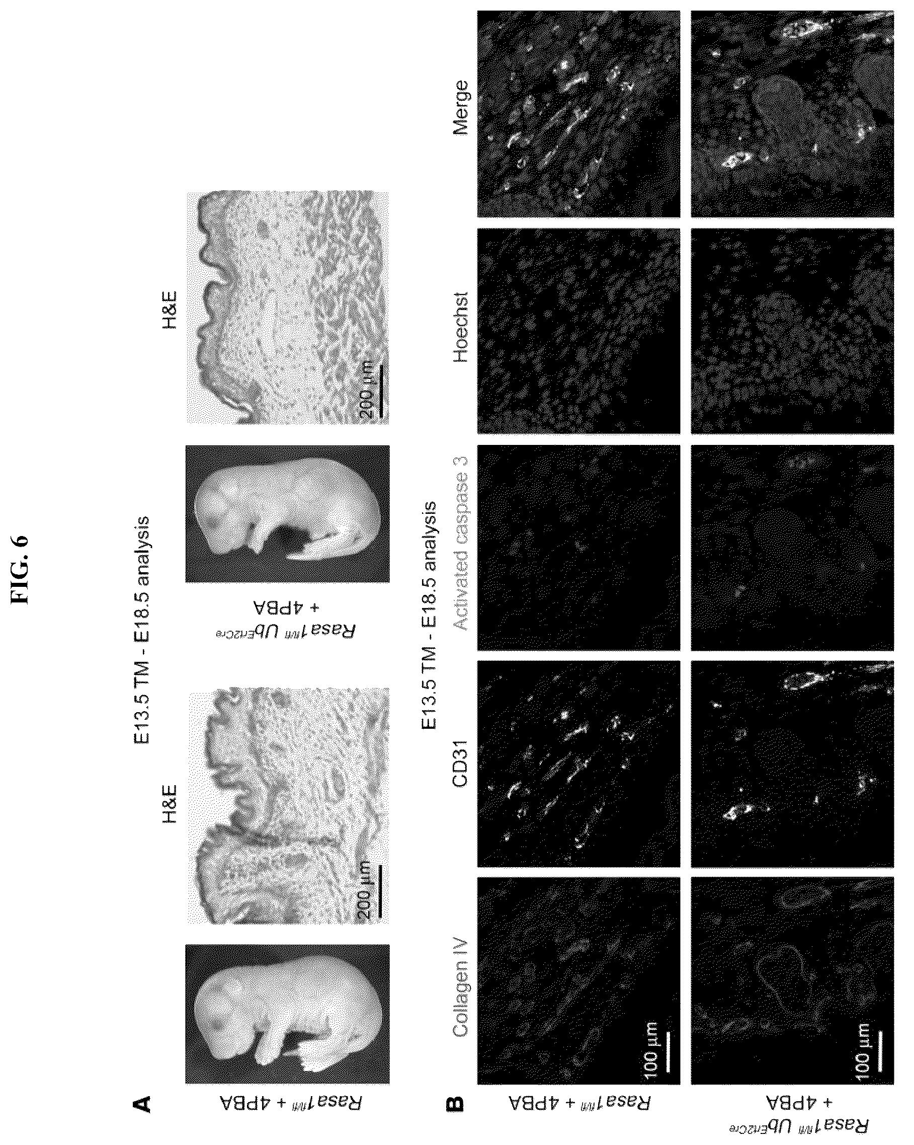 Patent US12472189 Figure 6 – Treatment and prevention of capillary malformation-arteriovenous malformation