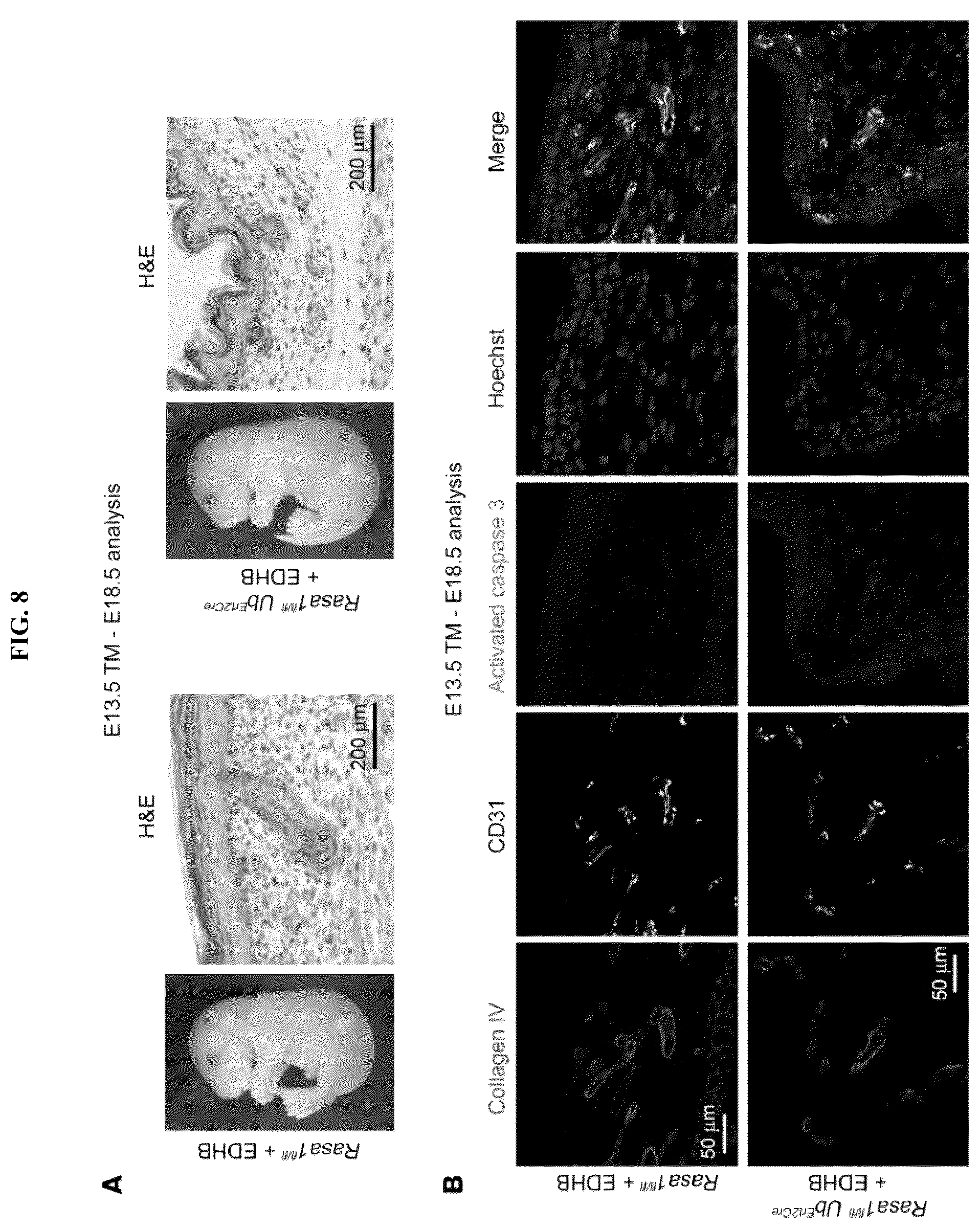 Patent US12472189 Figure 8 – Treatment and prevention of capillary malformation-arteriovenous malformation