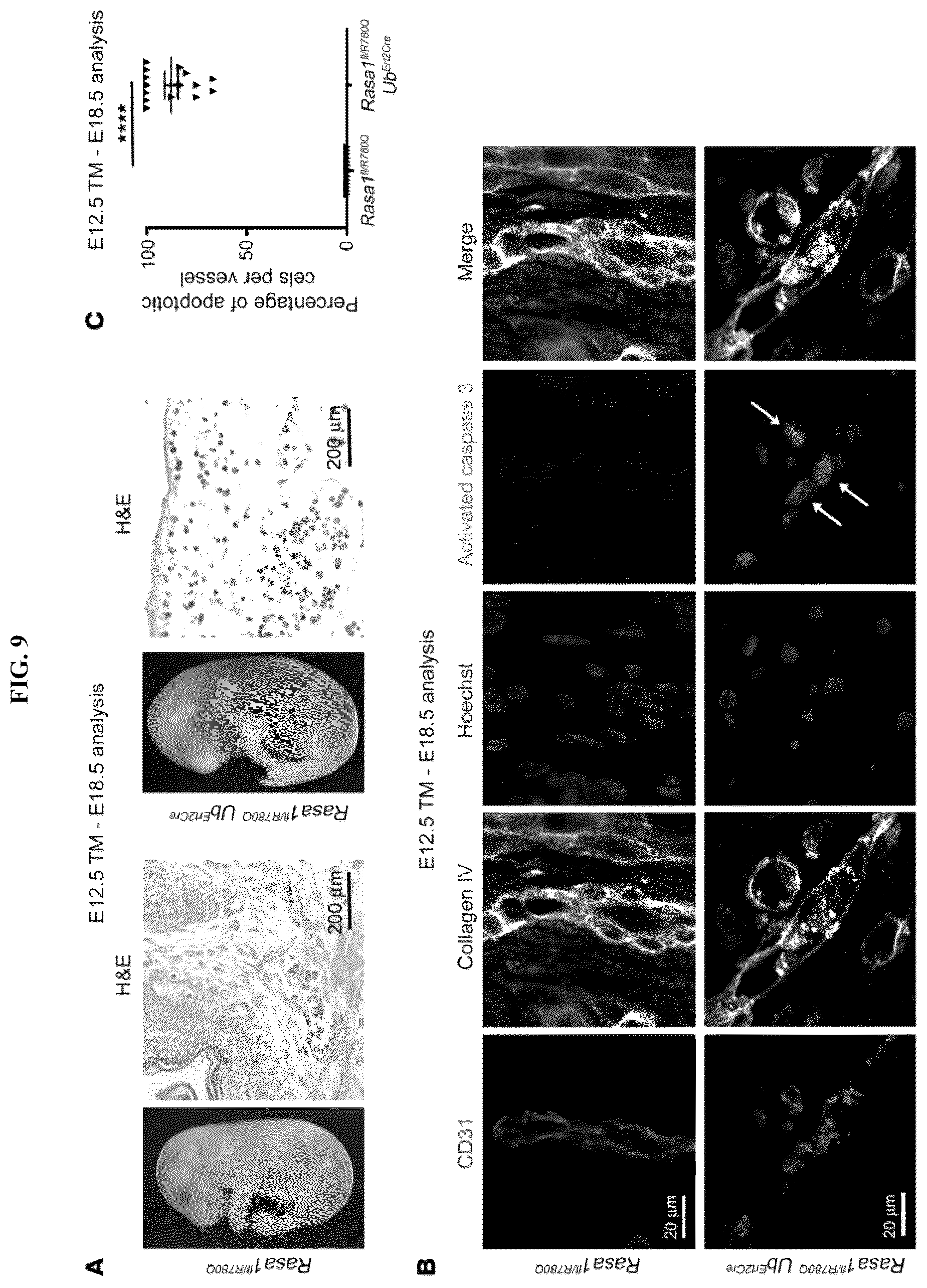 Patent US12472189 Figure 9 – Treatment and prevention of capillary malformation-arteriovenous malformation