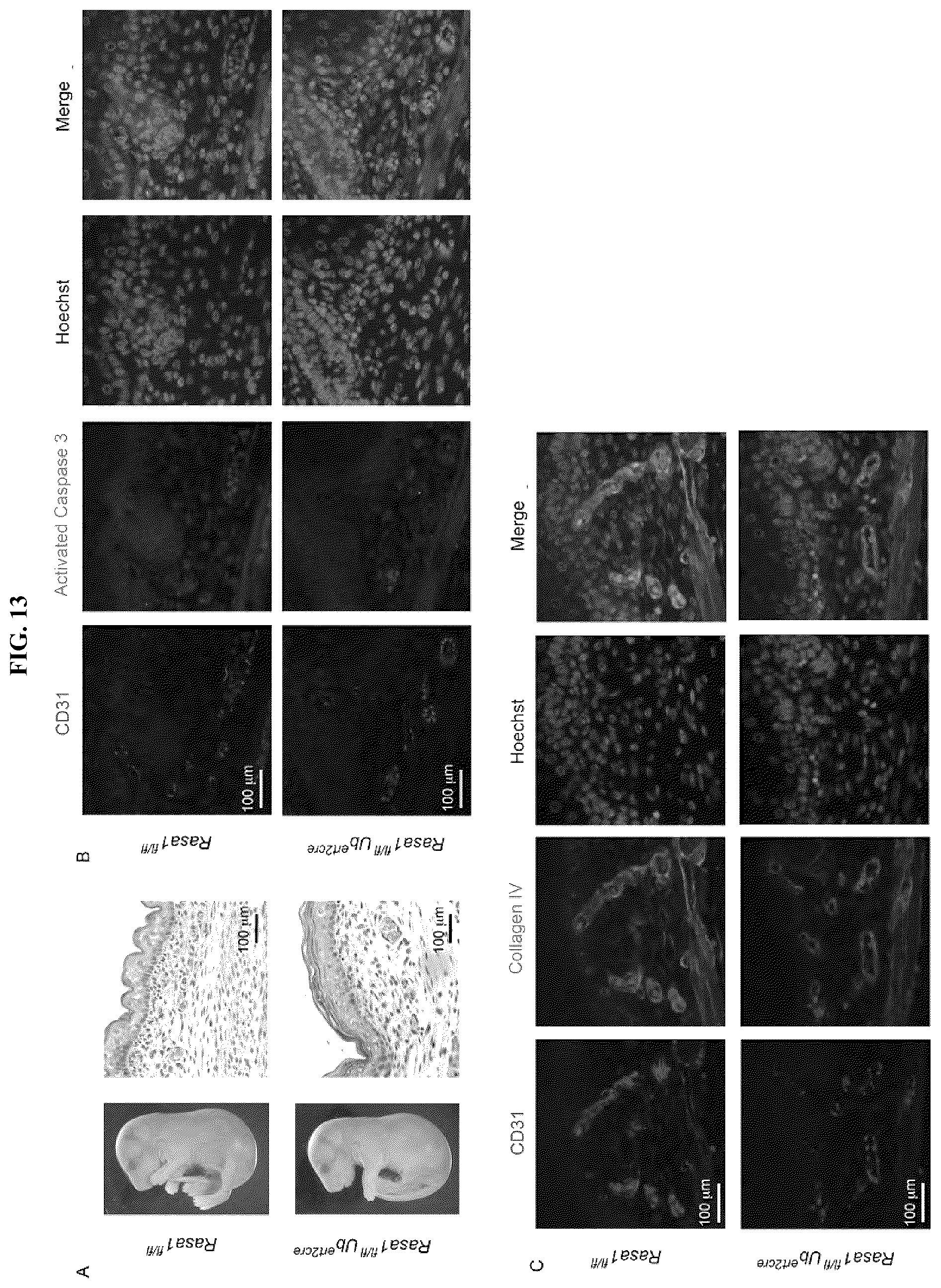 Patent US12472189 Figure 16 – Treatment and prevention of capillary malformation-arteriovenous malformation