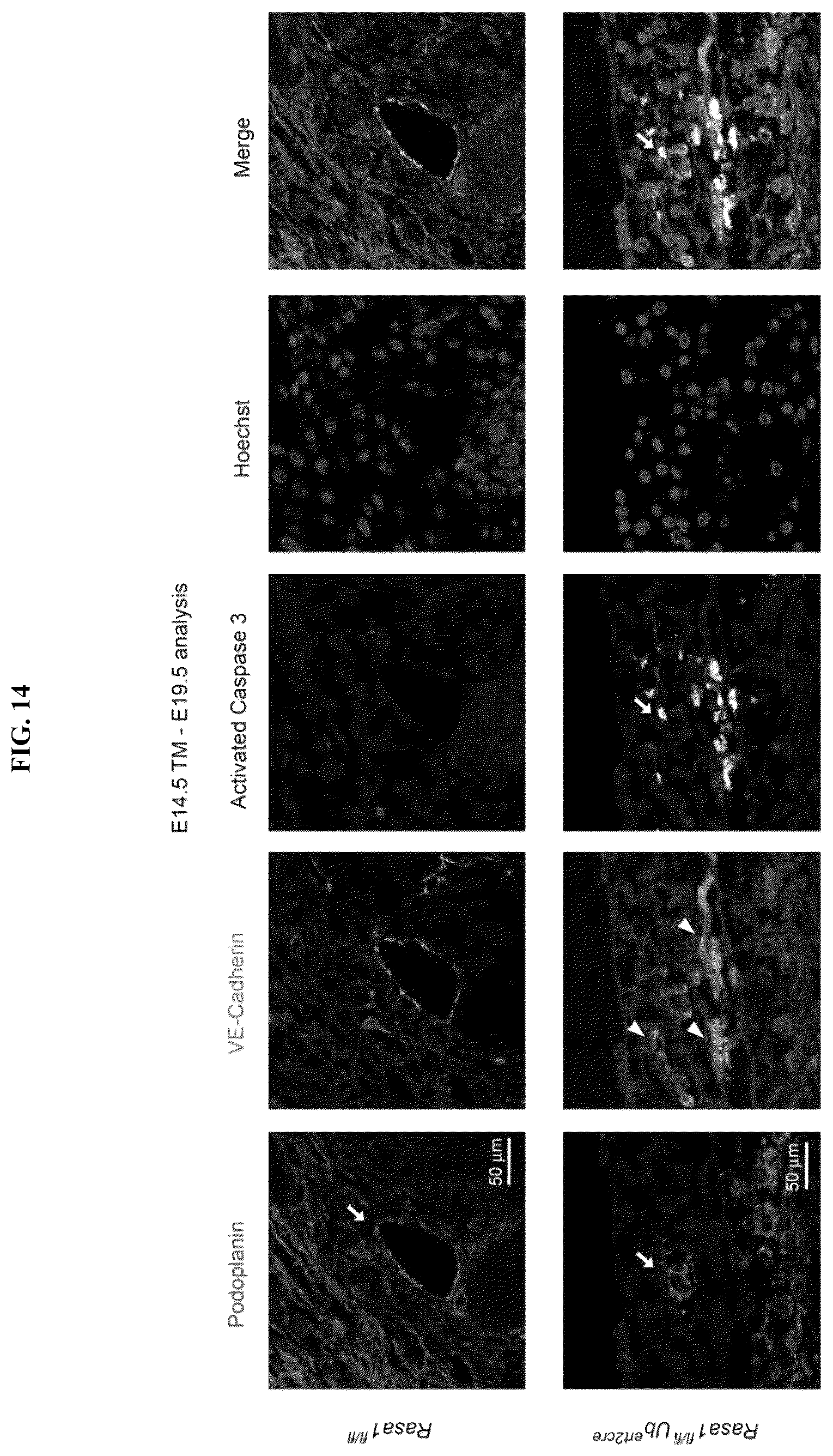 Patent US12472189 Figure 17 – Treatment and prevention of capillary malformation-arteriovenous malformation