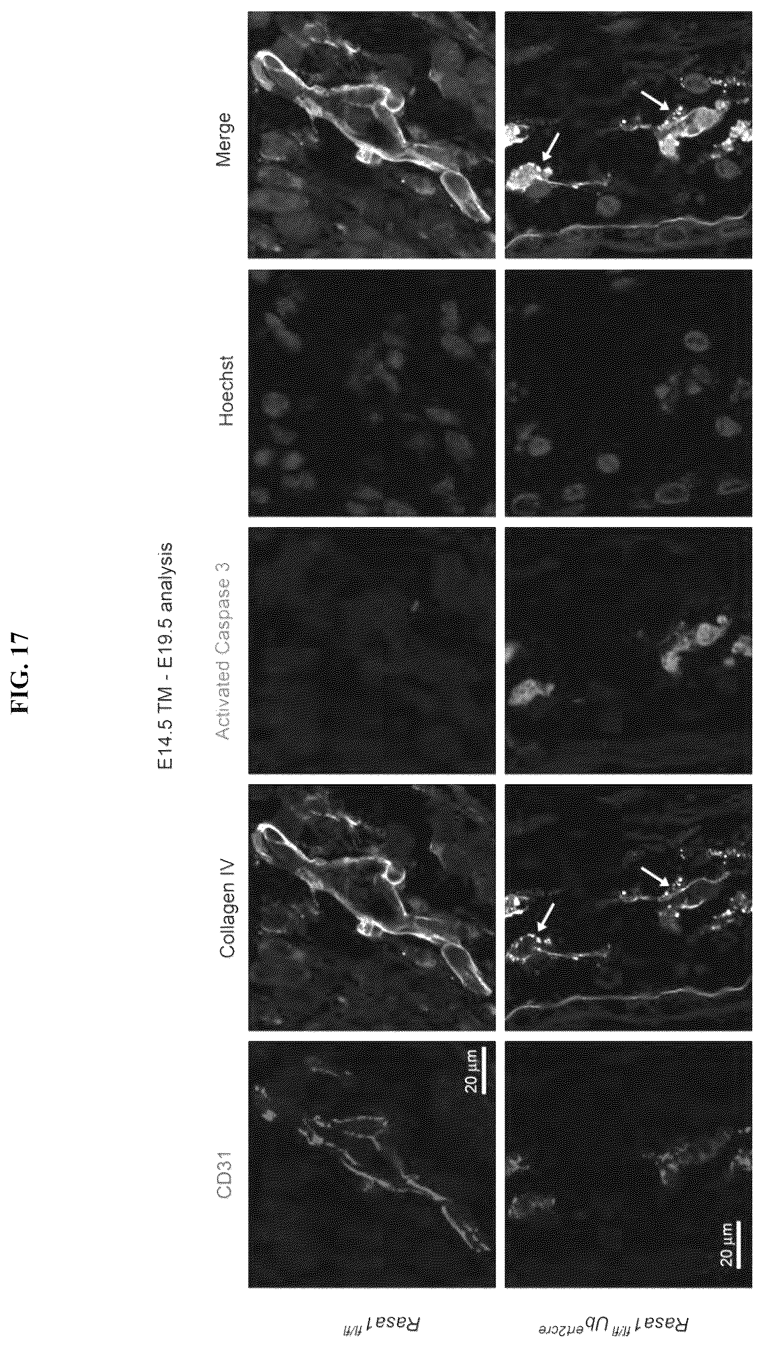 Patent US12472189 Figure 20 – Treatment and prevention of capillary malformation-arteriovenous malformation