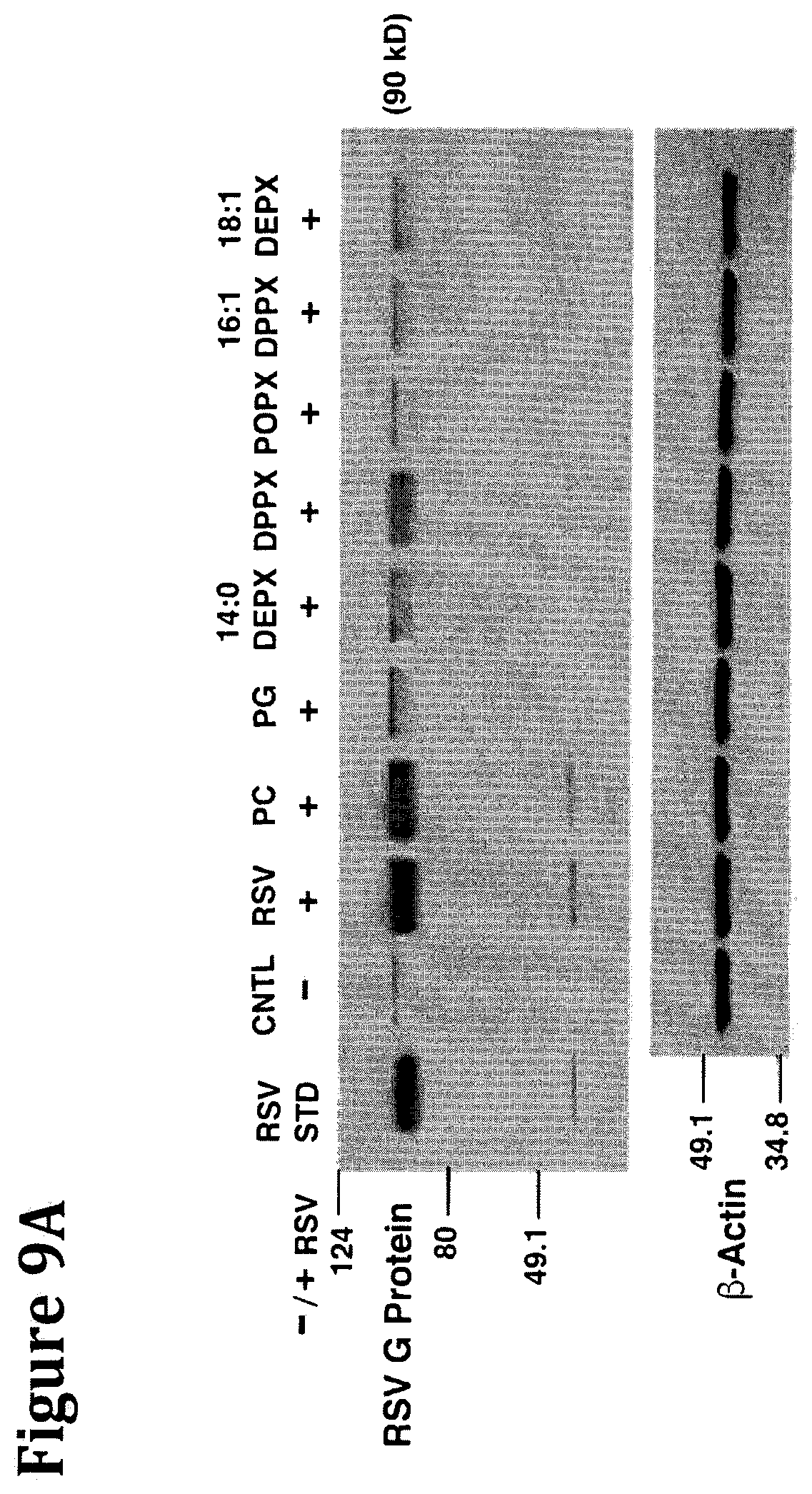 Patent US12472193 Figure 17 – Methods and compositions for treating and preventing respiratory related diseases and conditions with xylitol-headgroup lipid analogs