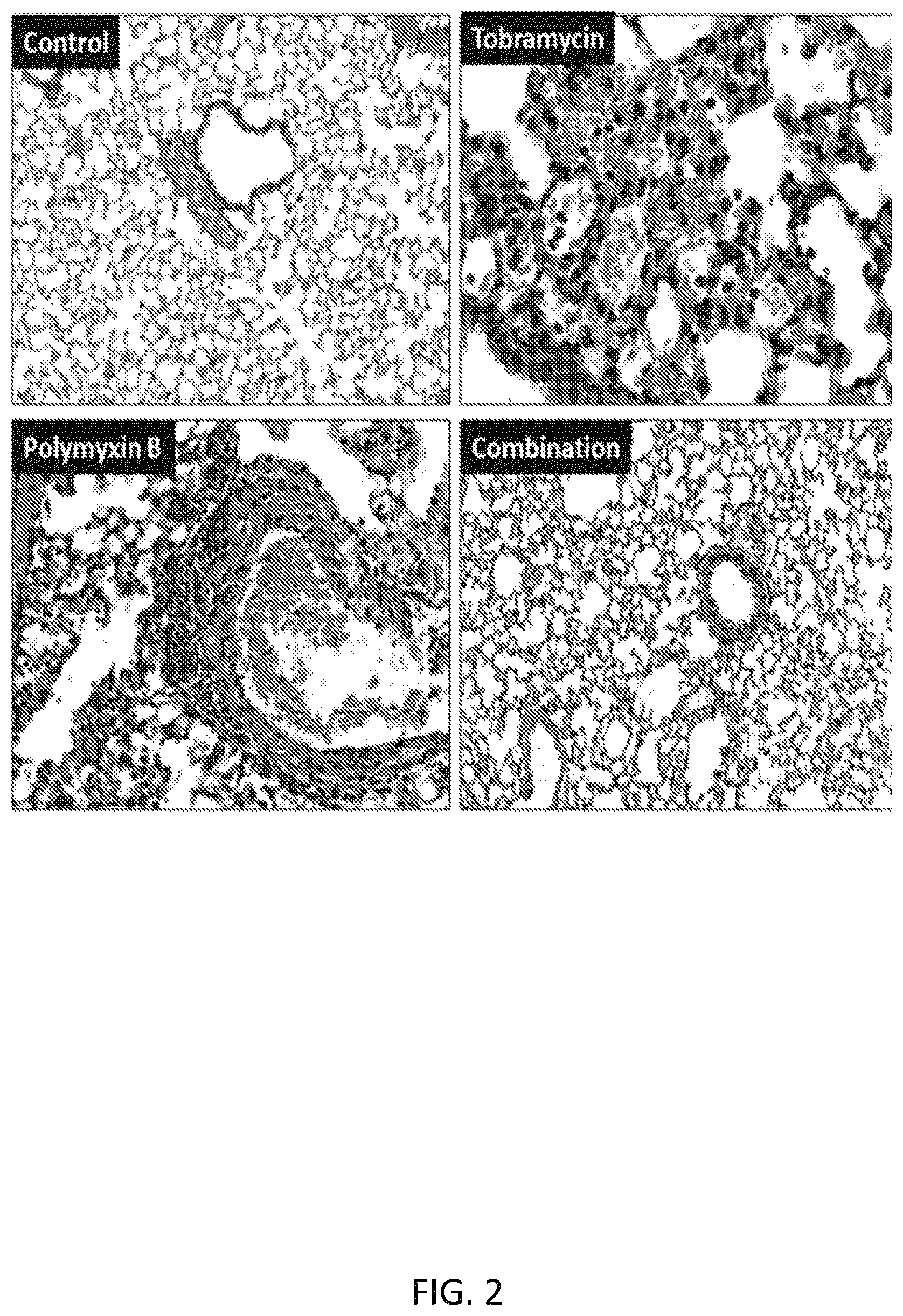 Patent US12472195 Figure 2 – Inhalation formulations of antimicrobial compounds