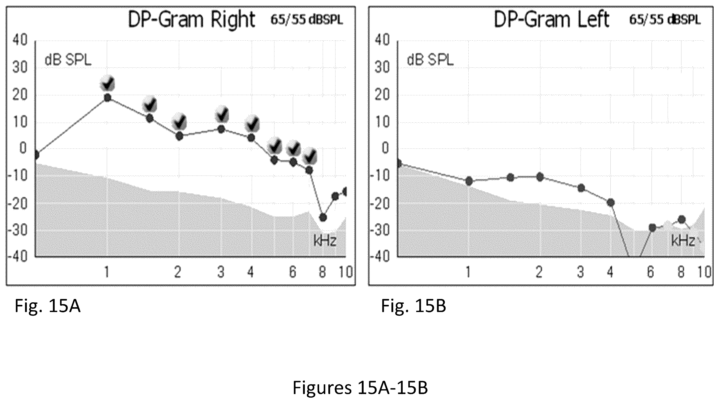 Patent US12472203 Figure 15 – Composition and method for treating hearing loss