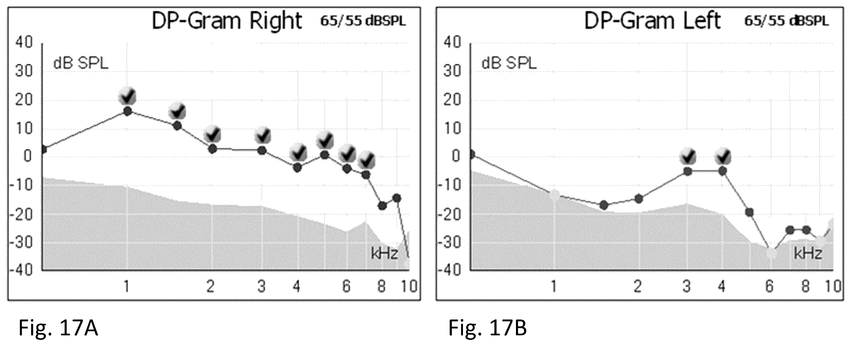 Patent US12472203 Figure 17 – Composition and method for treating hearing loss