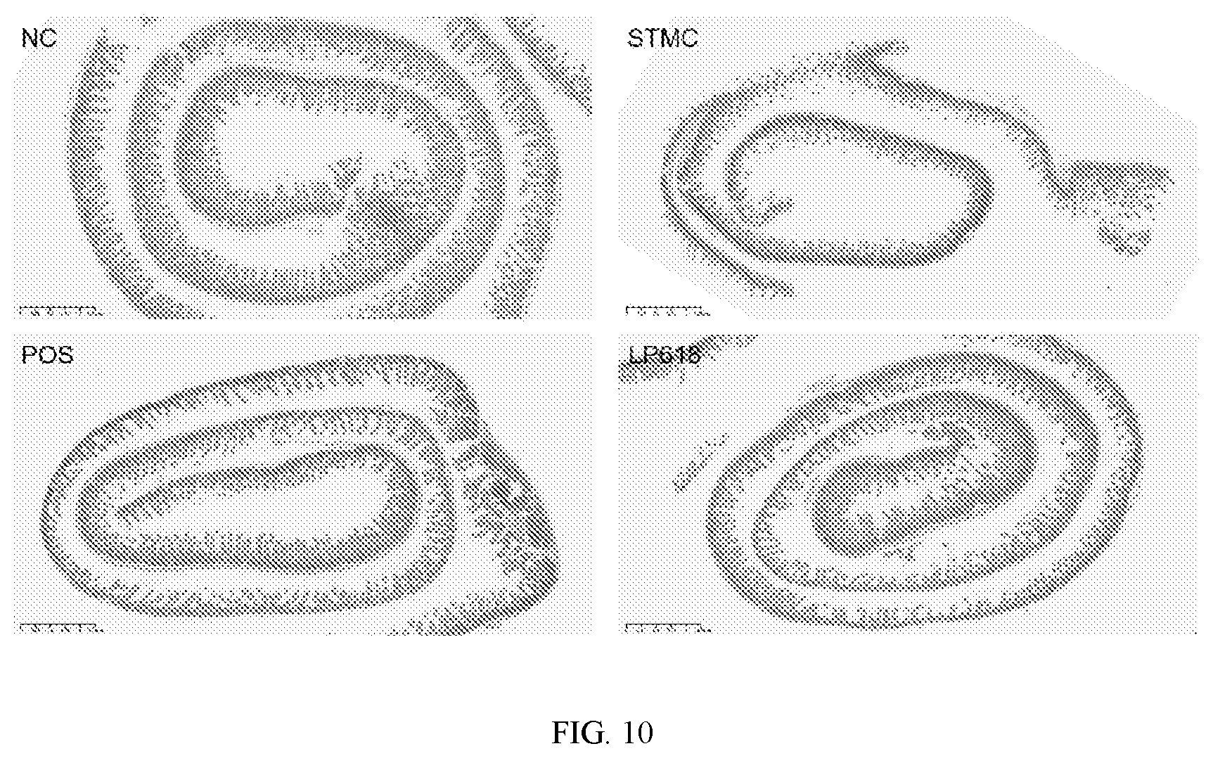 Patent US12472212 Figure 10 – Lactiplantibacillus plantarum GOLDGUT-LP618 having function of resisting salmonella infection and application thereof