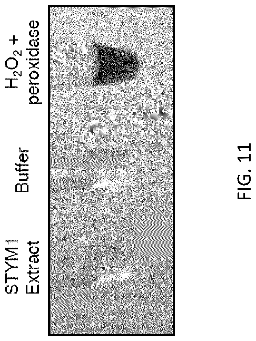 Patent US12472213 Figure 15 – Strains of Lactobacillus delbrueckii which inhibit Porphyromonas gingivalis