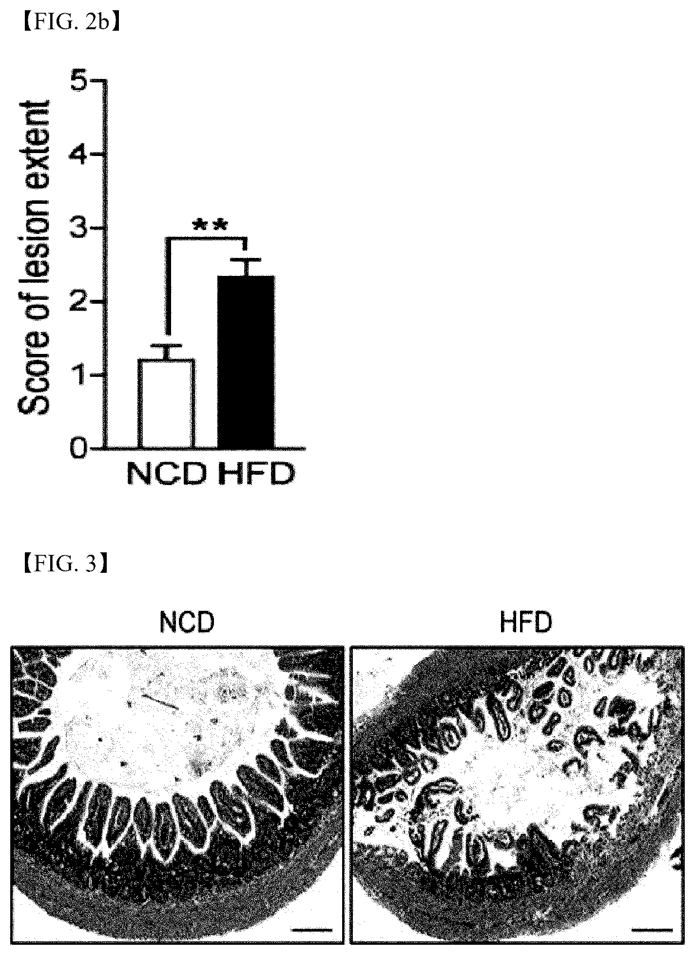 Patent US12472215 Figure 2 – Lactobacillus helveticus strain and composition containing same for prevention or treatment of inflammatory diseases
