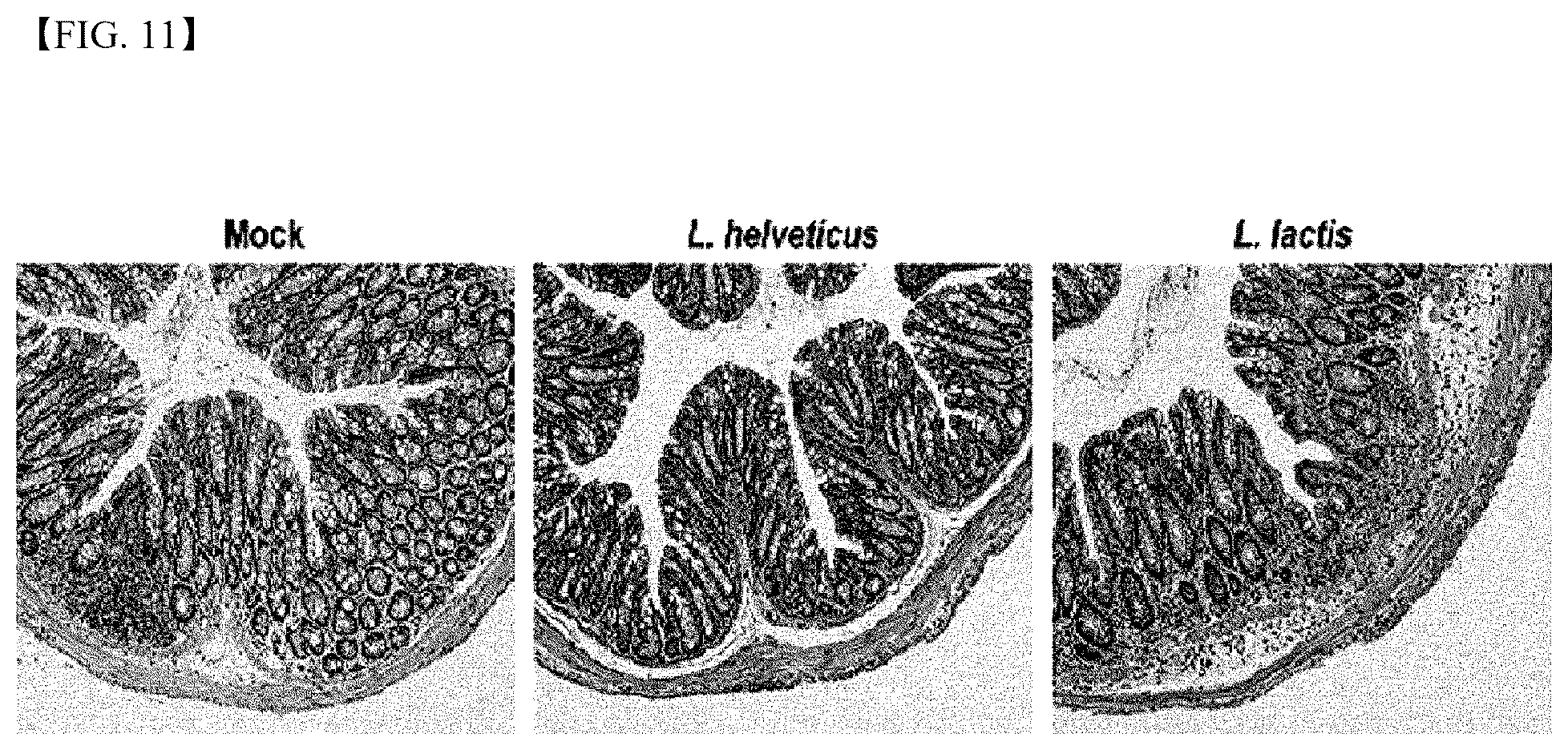 Patent US12472215 Figure 10 – Lactobacillus helveticus strain and composition containing same for prevention or treatment of inflammatory diseases