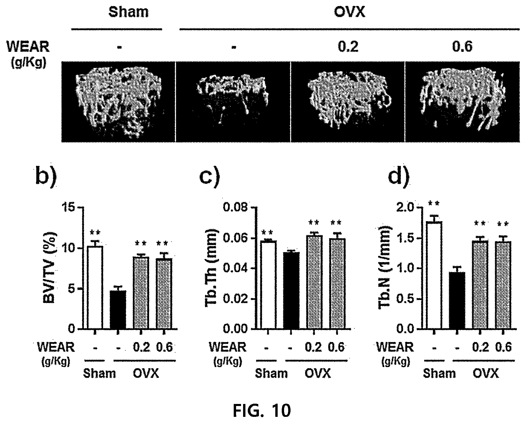 Patent US12472221 Figure 10 – Composition for inhibiting osteoclasts containing agastache rugosa extract as active ingredient, and use thereof