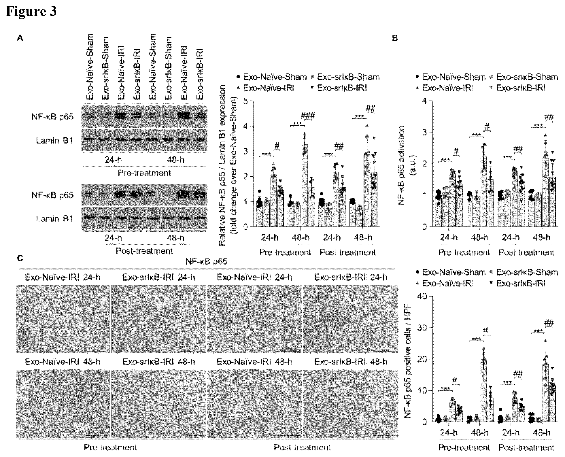 Patent US12472228 Figure 3 – Use of exosome-based delivery of NF-κB inhibitors