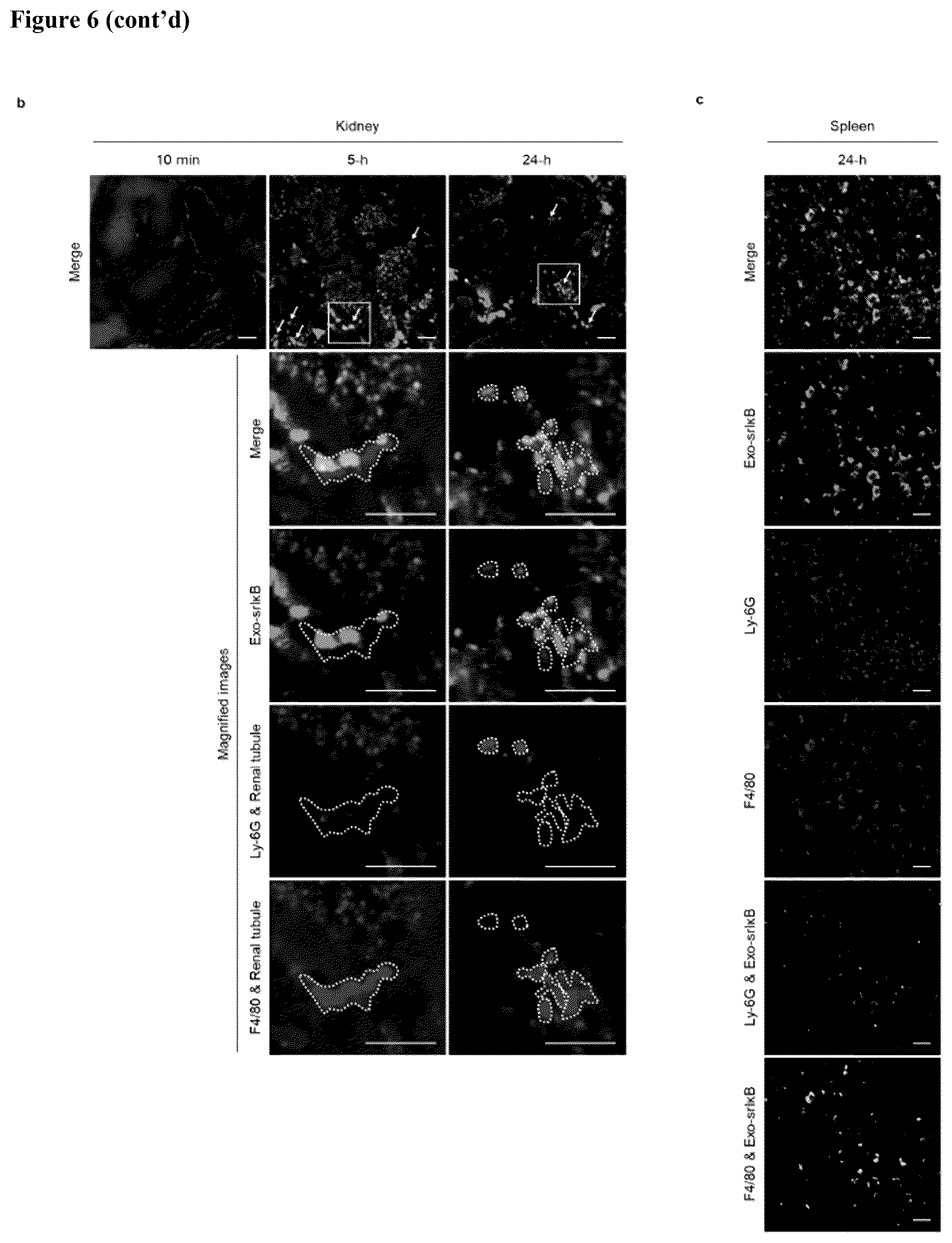 Patent US12472228 Figure 8 – Use of exosome-based delivery of NF-κB inhibitors