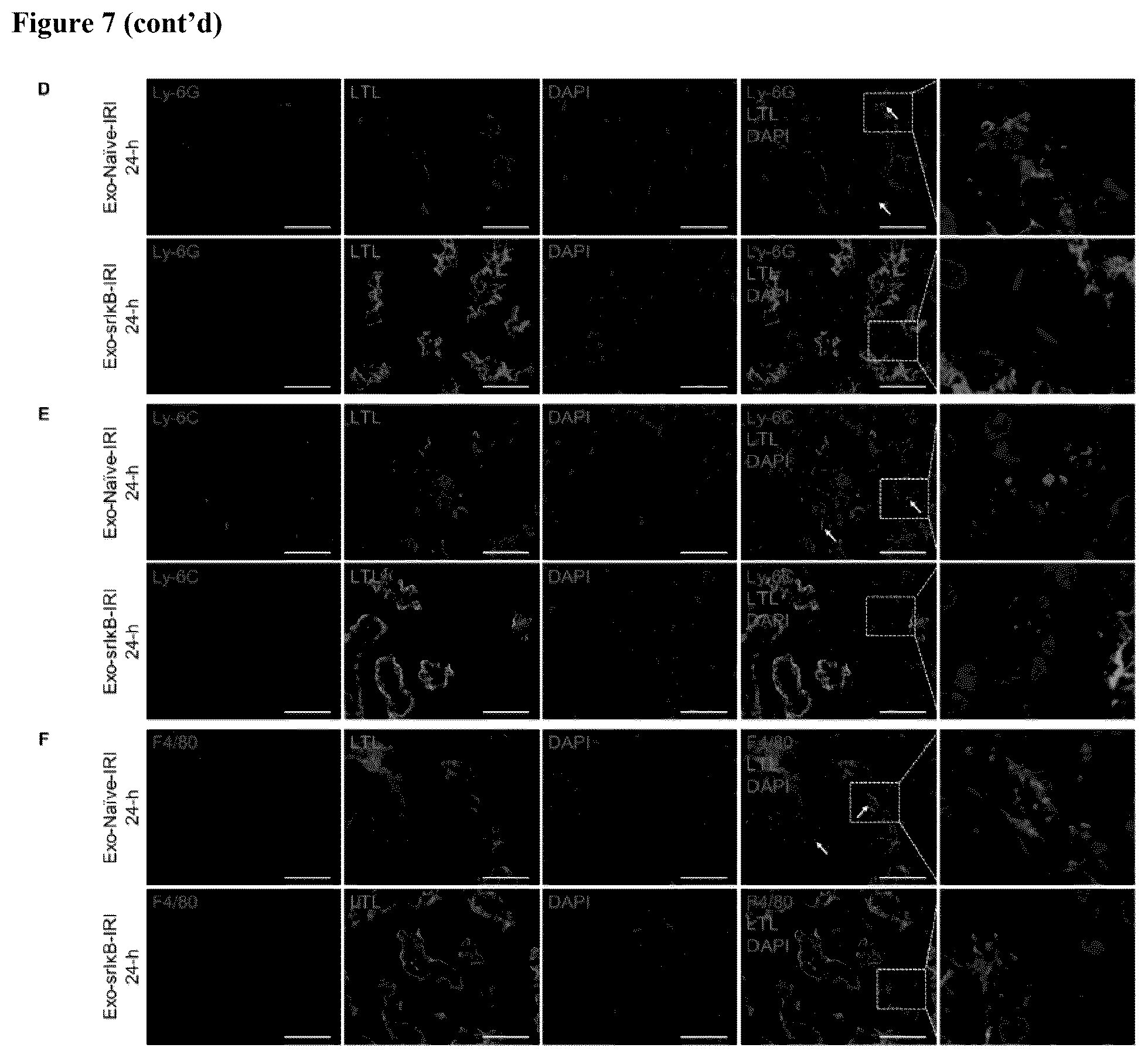 Patent US12472228 Figure 10 – Use of exosome-based delivery of NF-κB inhibitors
