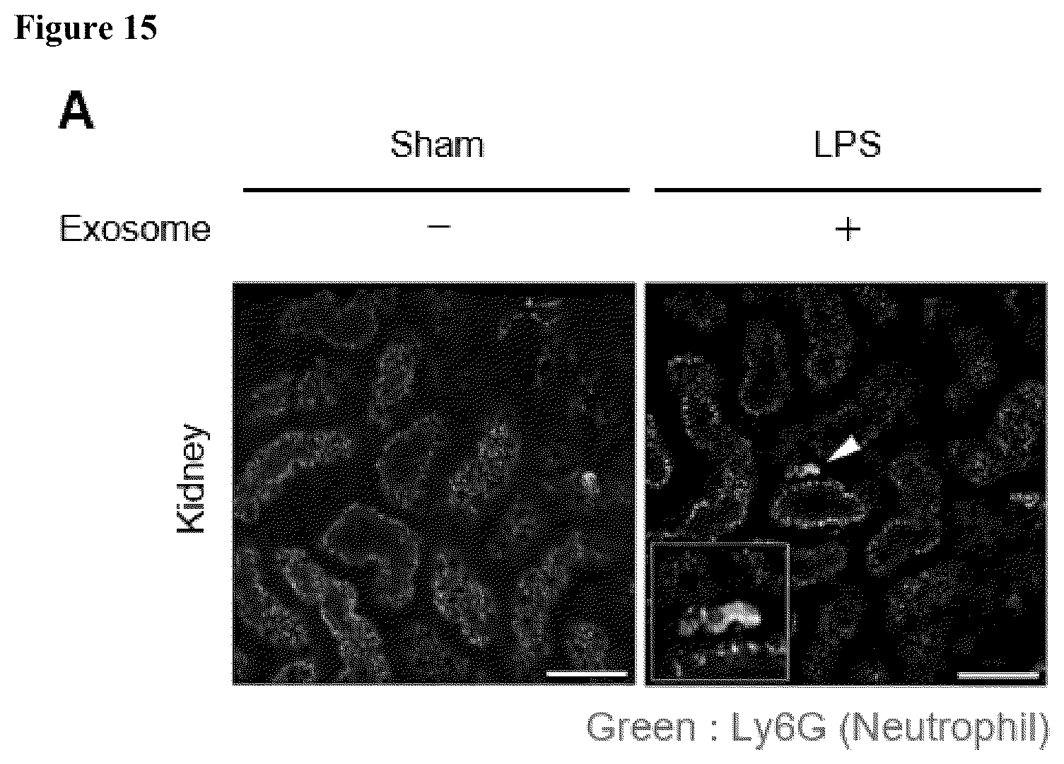Patent US12472228 Figure 19 – Use of exosome-based delivery of NF-κB inhibitors
