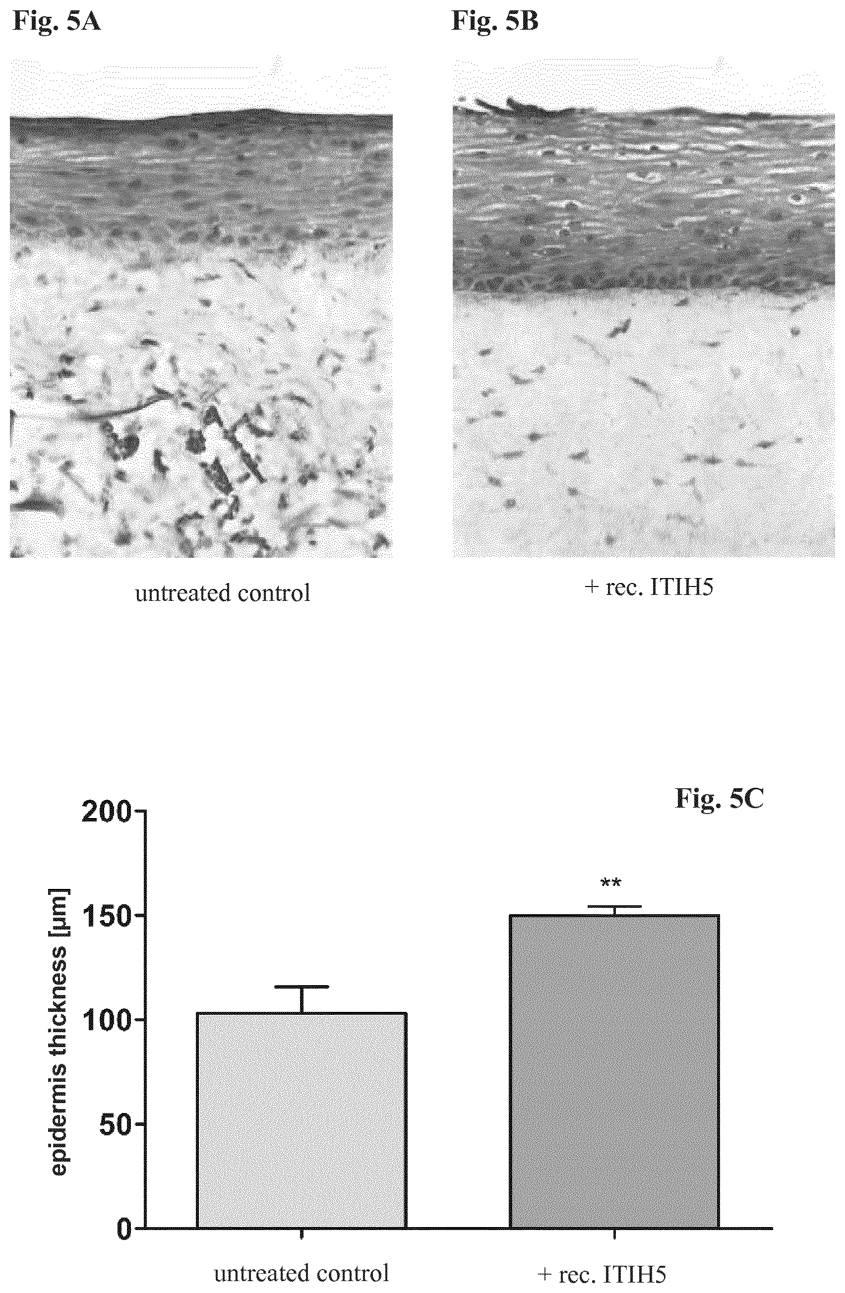 Patent US12472229 Figure 5 – Hyaluronic acid stabilizer