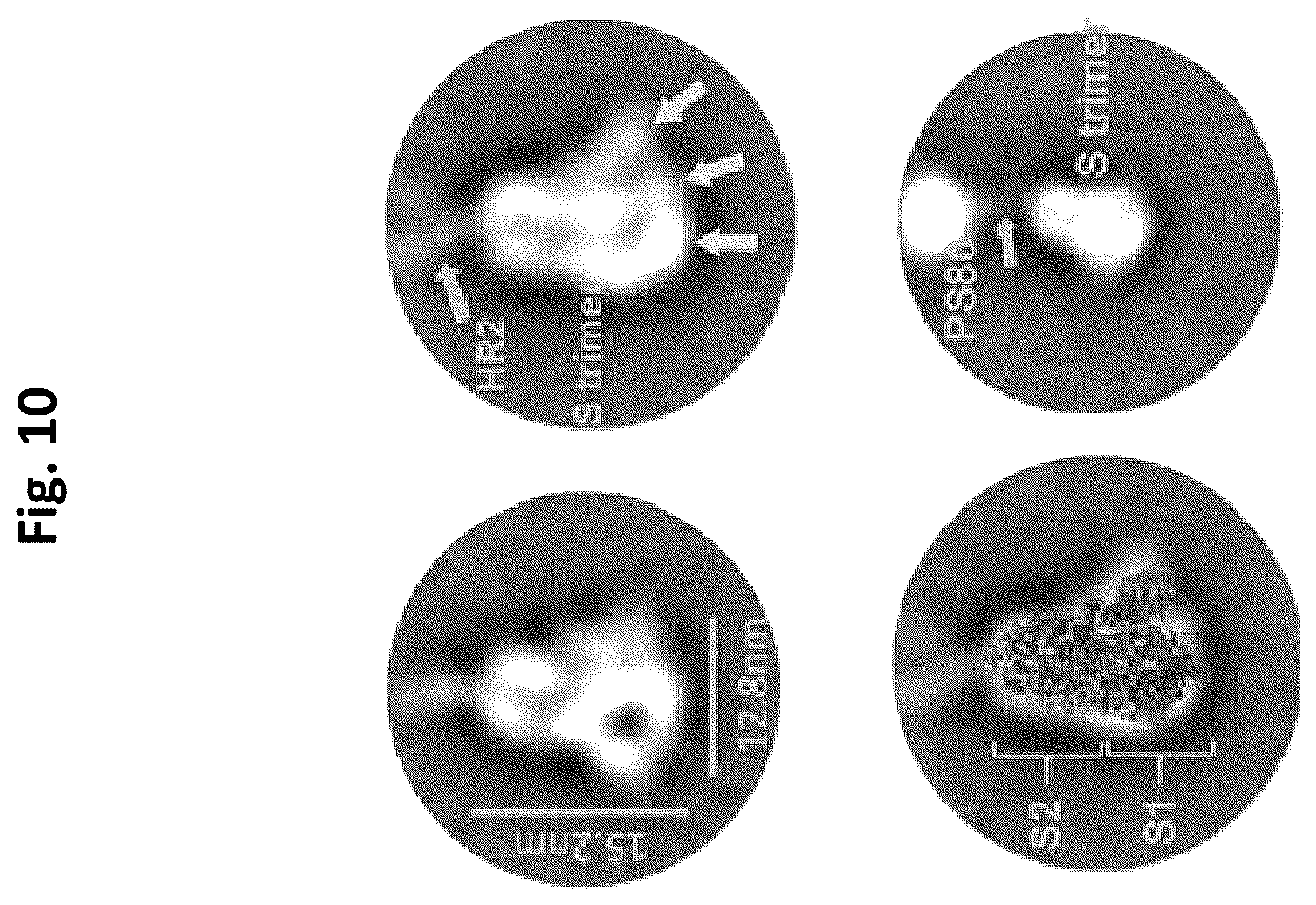 Patent US12472246 Figure 10 – Coronavirus vaccine formulations