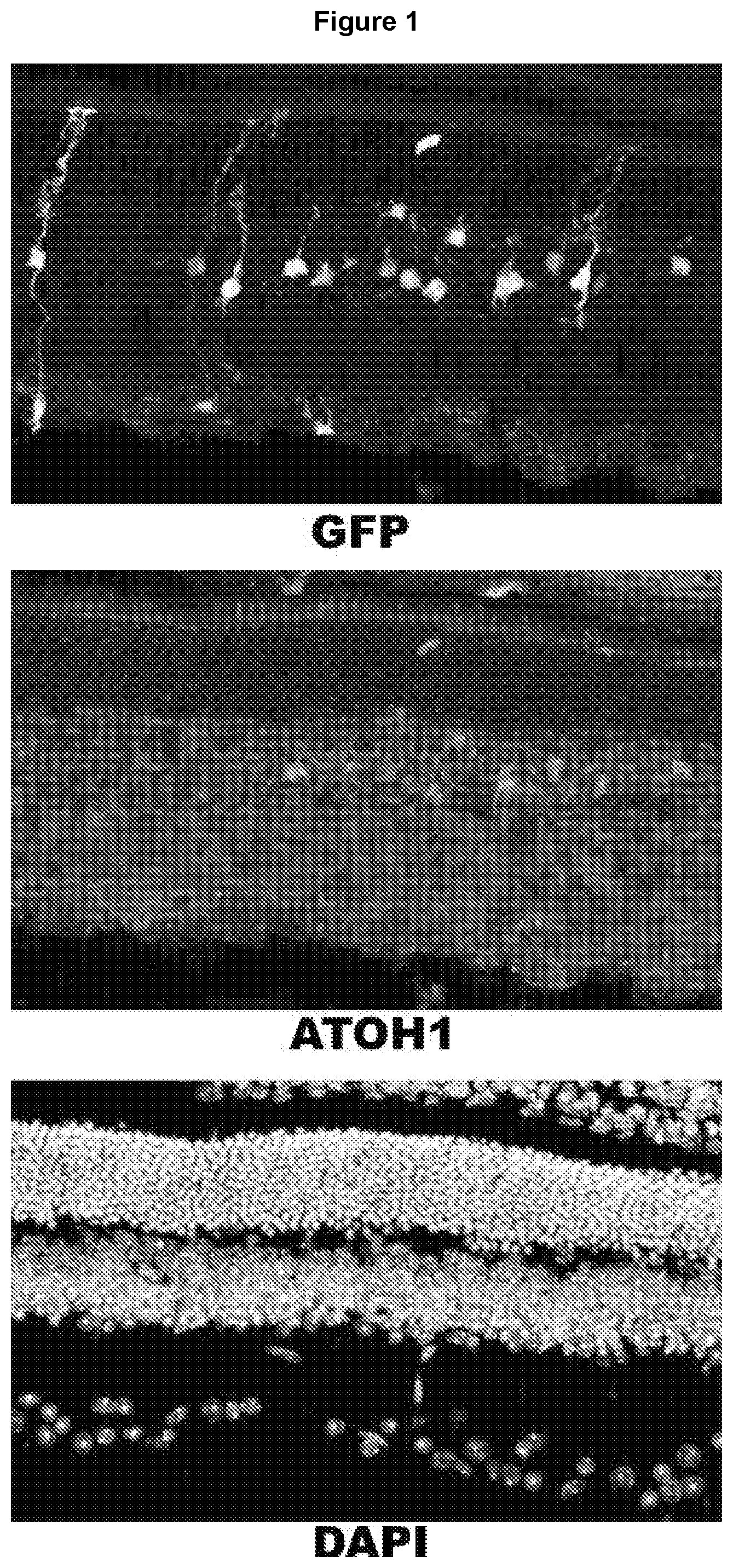 Patent US12472270 Figure 1 – Methods and compositions for reprogramming Müller Glia