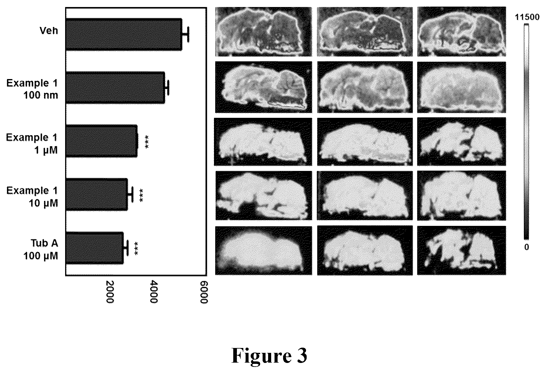 Patent US12472271 Figure 3 – HDAC6 inhibitors and imaging agents