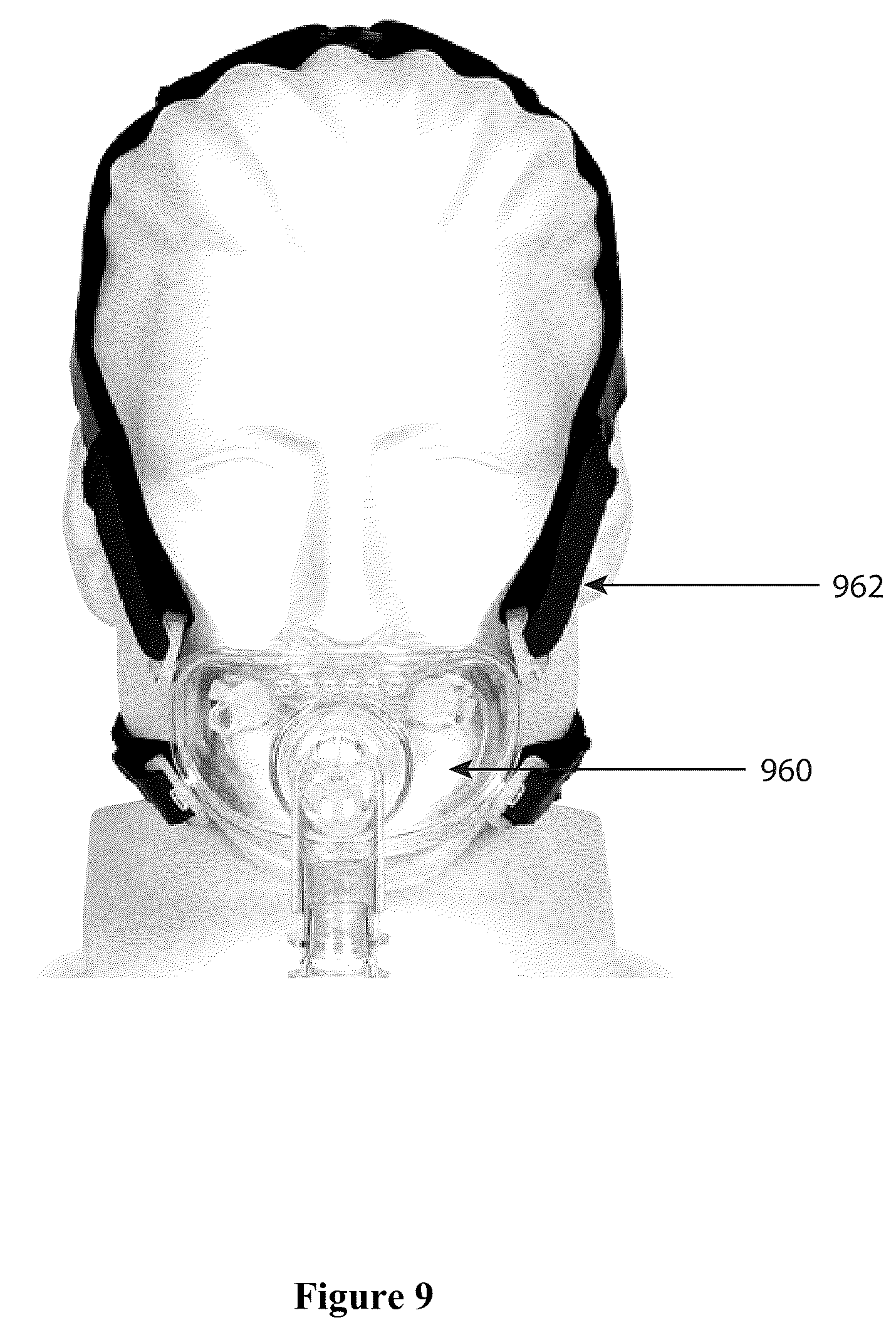 Patent US12472278 Figure 10 – Systems, methods, and devices for ozone sanitization of continuous positive airway pressure devices