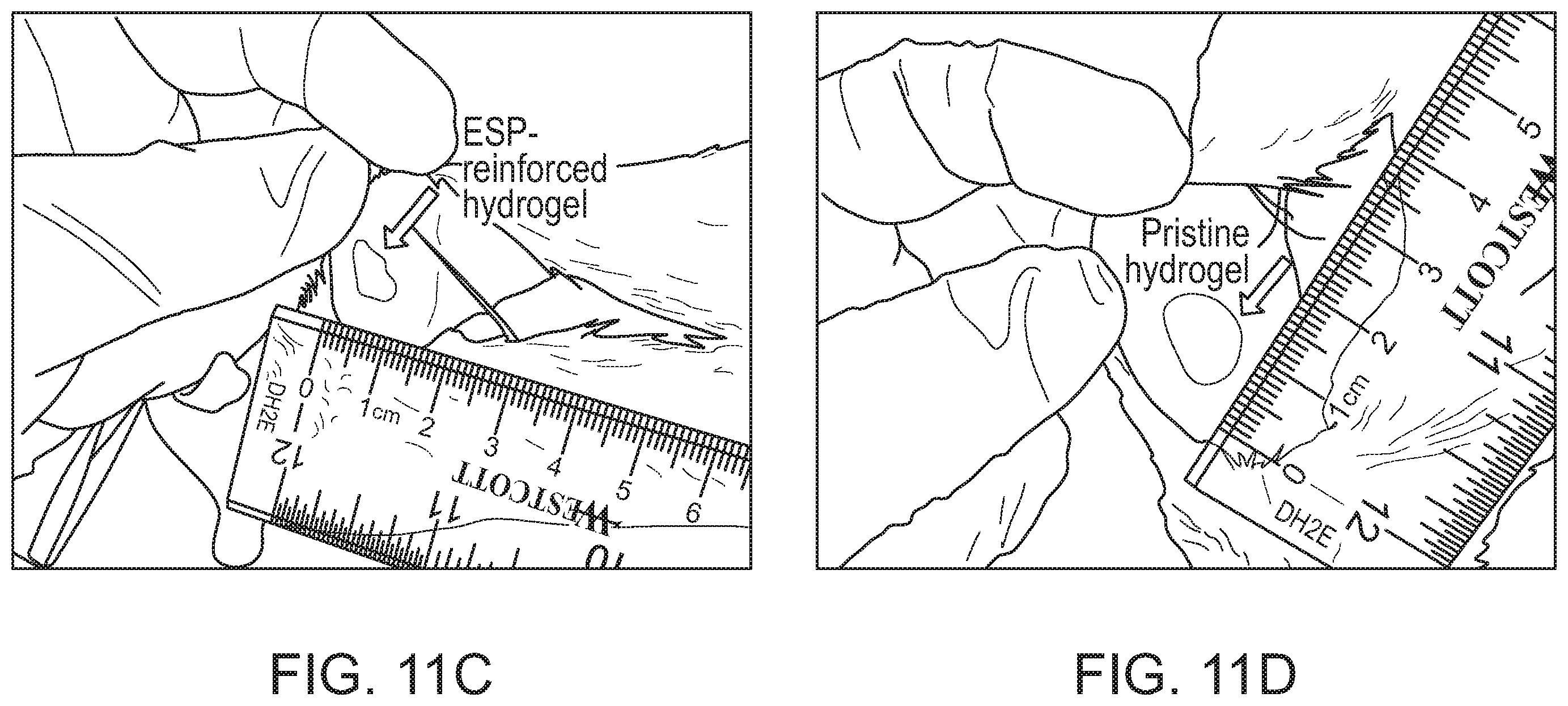 Patent US12472285 Figure 17 – Eggshell particle containing hydrogels and prepolymer compositions for biomedical applications
