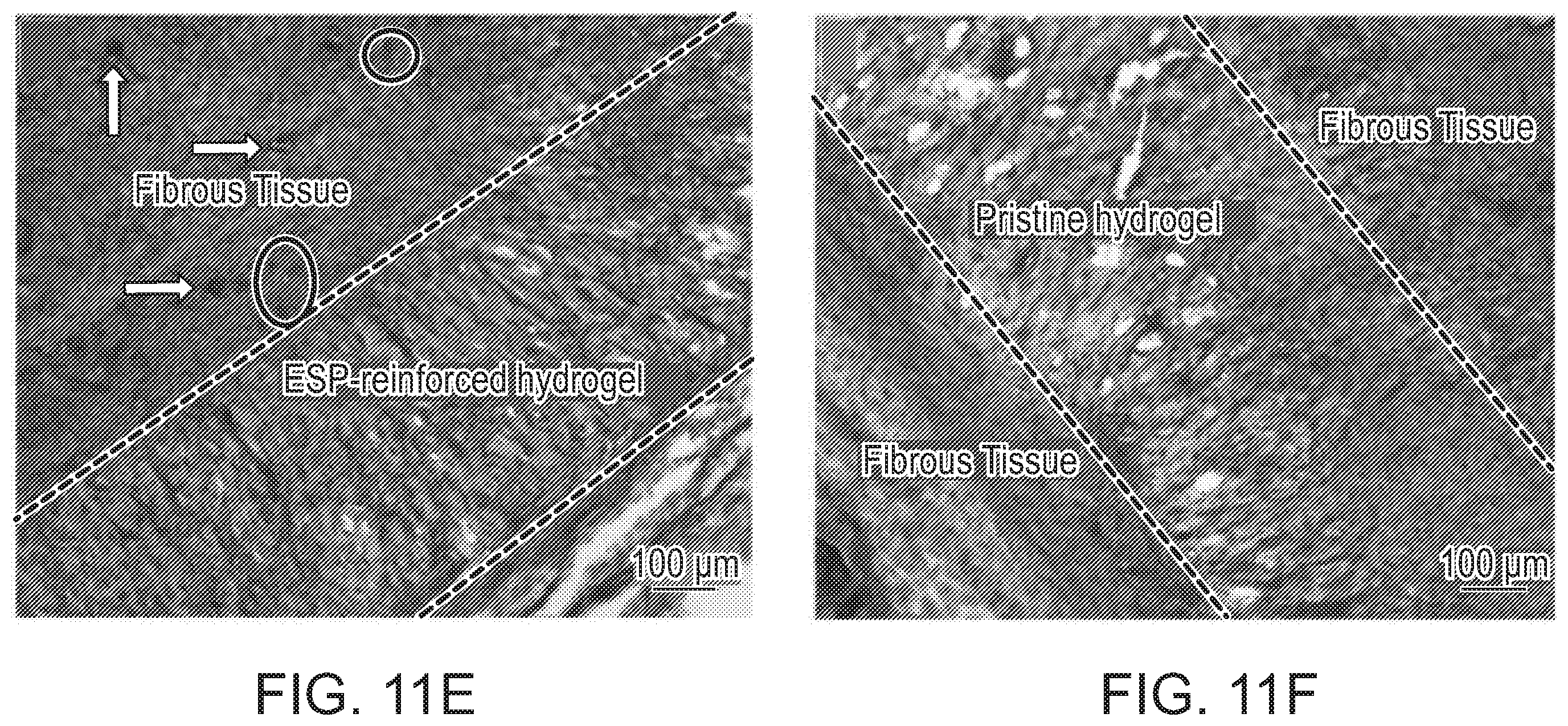 Patent US12472285 Figure 18 – Eggshell particle containing hydrogels and prepolymer compositions for biomedical applications