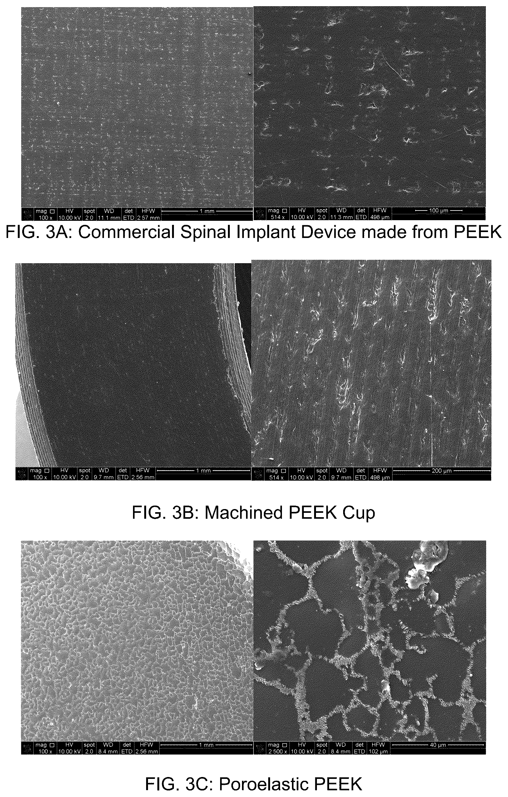 Patent US12472287 Figure 3 – Poroelastic biomaterial for orthopedic devices