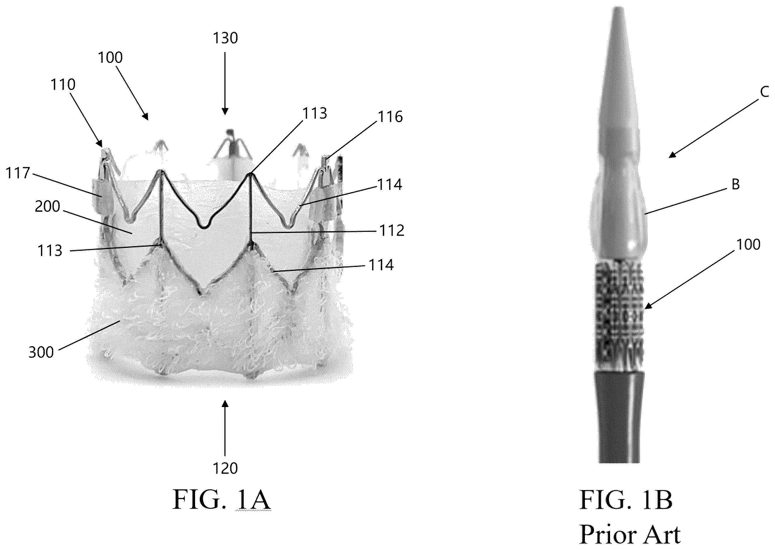 Patent US12472289 Figure 1 – Heart valve that includes coating material
