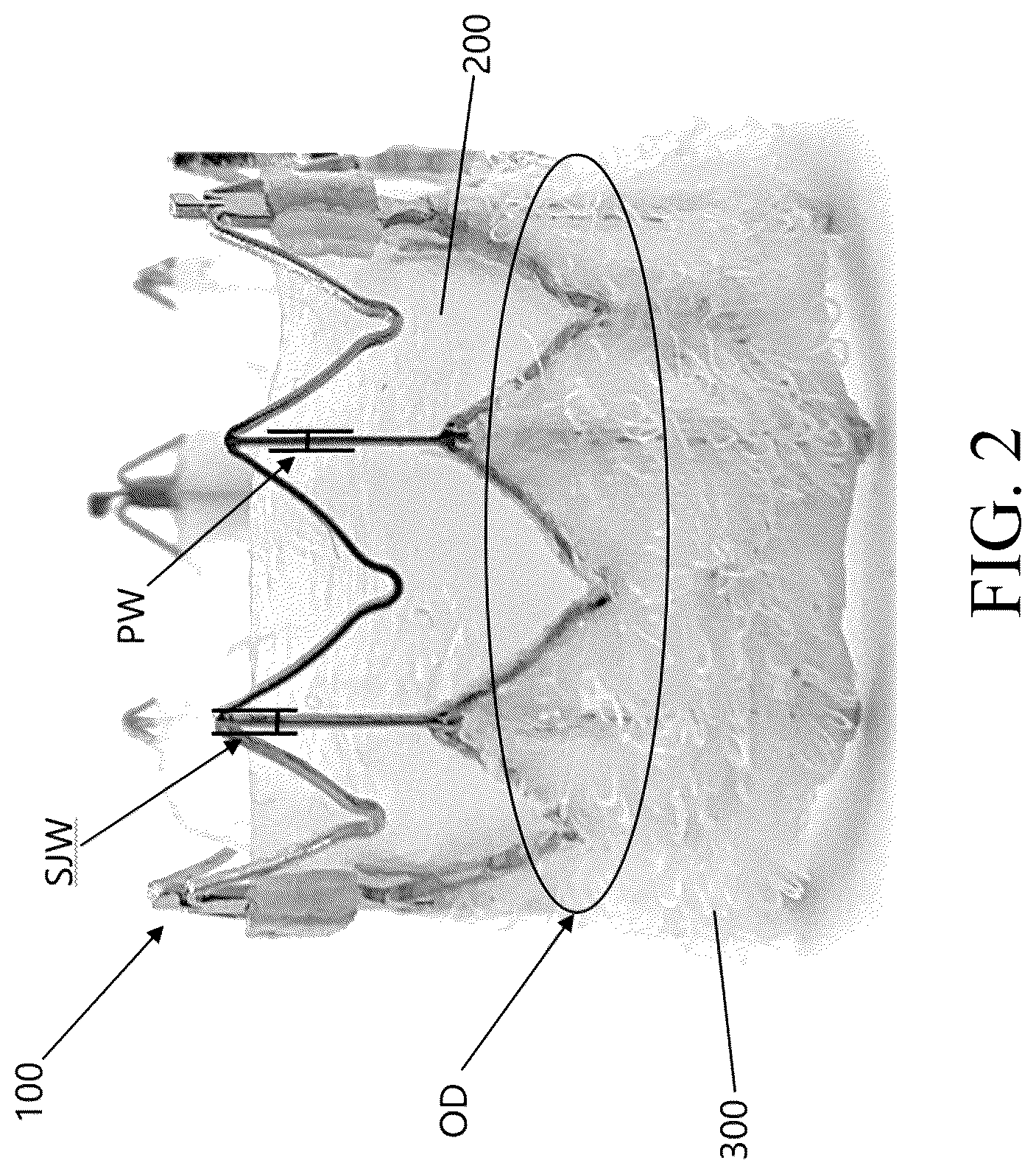 Patent US12472289 Figure 4 – Heart valve that includes coating material