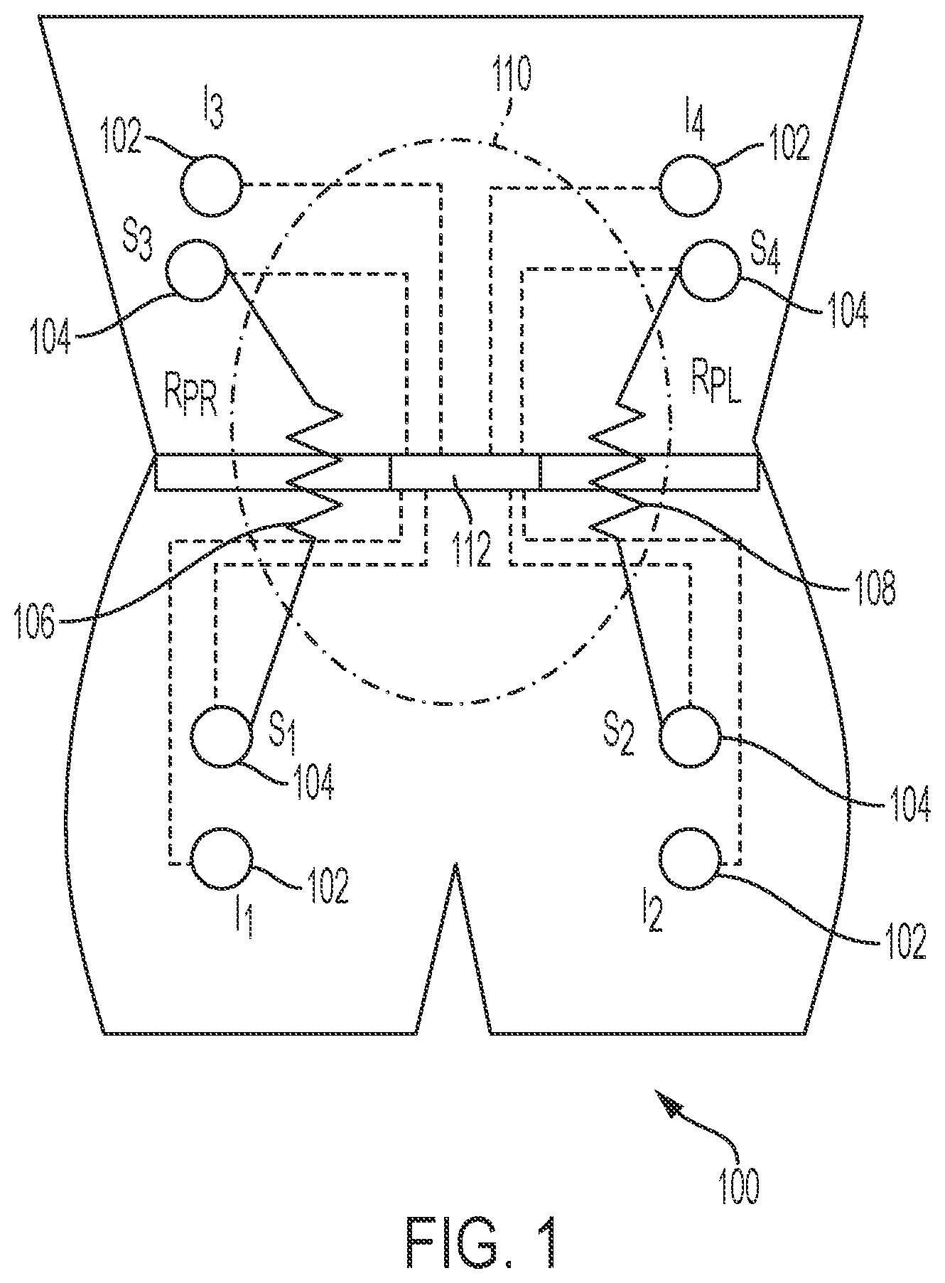 Patent US12472293 Figure 1 – Predicting ultrafiltration volume in peritoneal dialysis patients