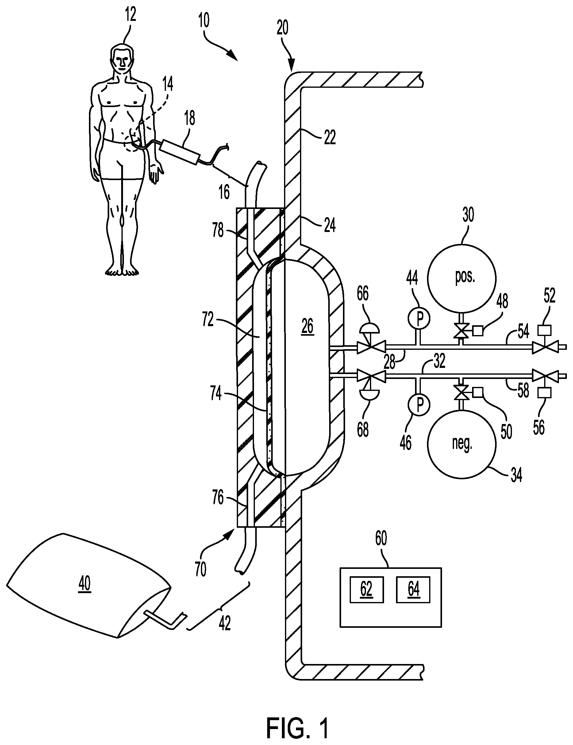 Patent US12472294 Figure 1 – Peritoneal dialysis system and method for minimizing patient drain pain