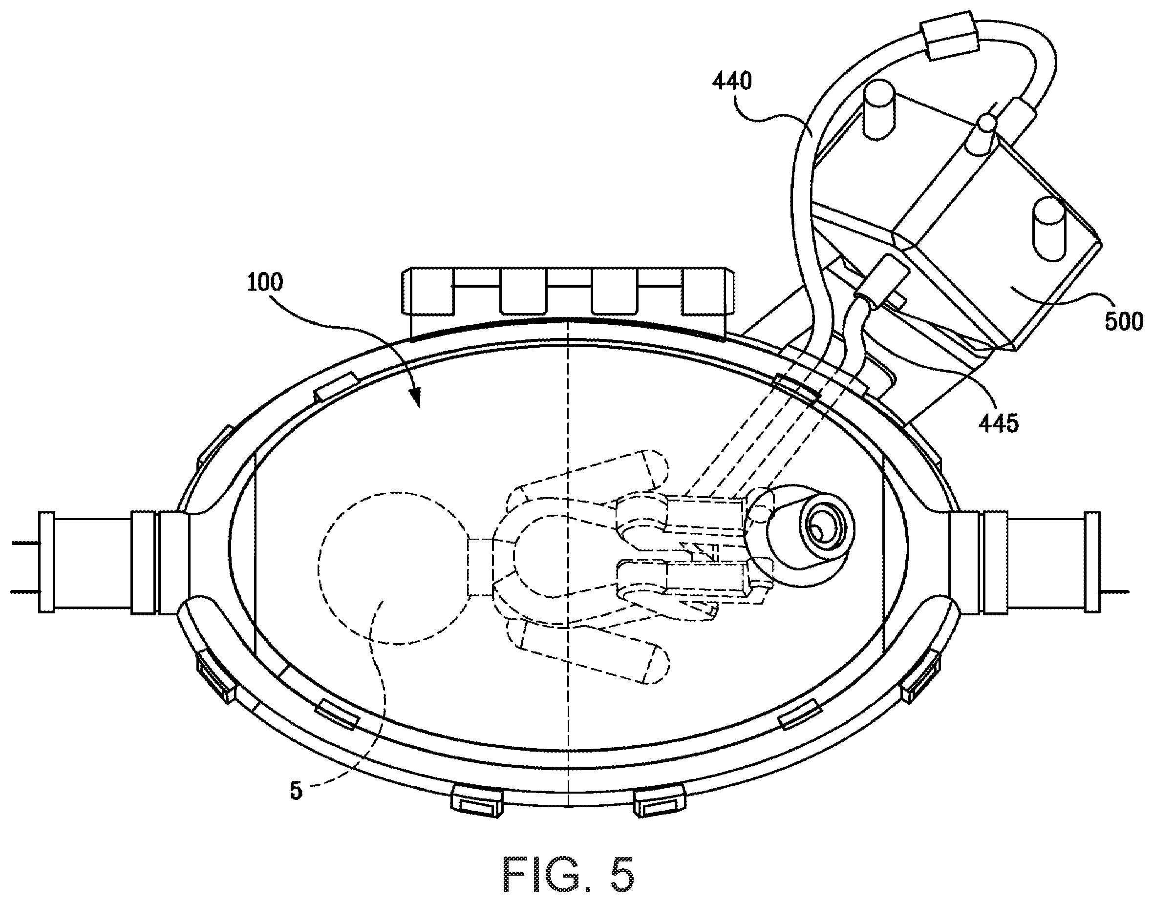 Patent US12472297 Figure 5 – Cannulator collet latch