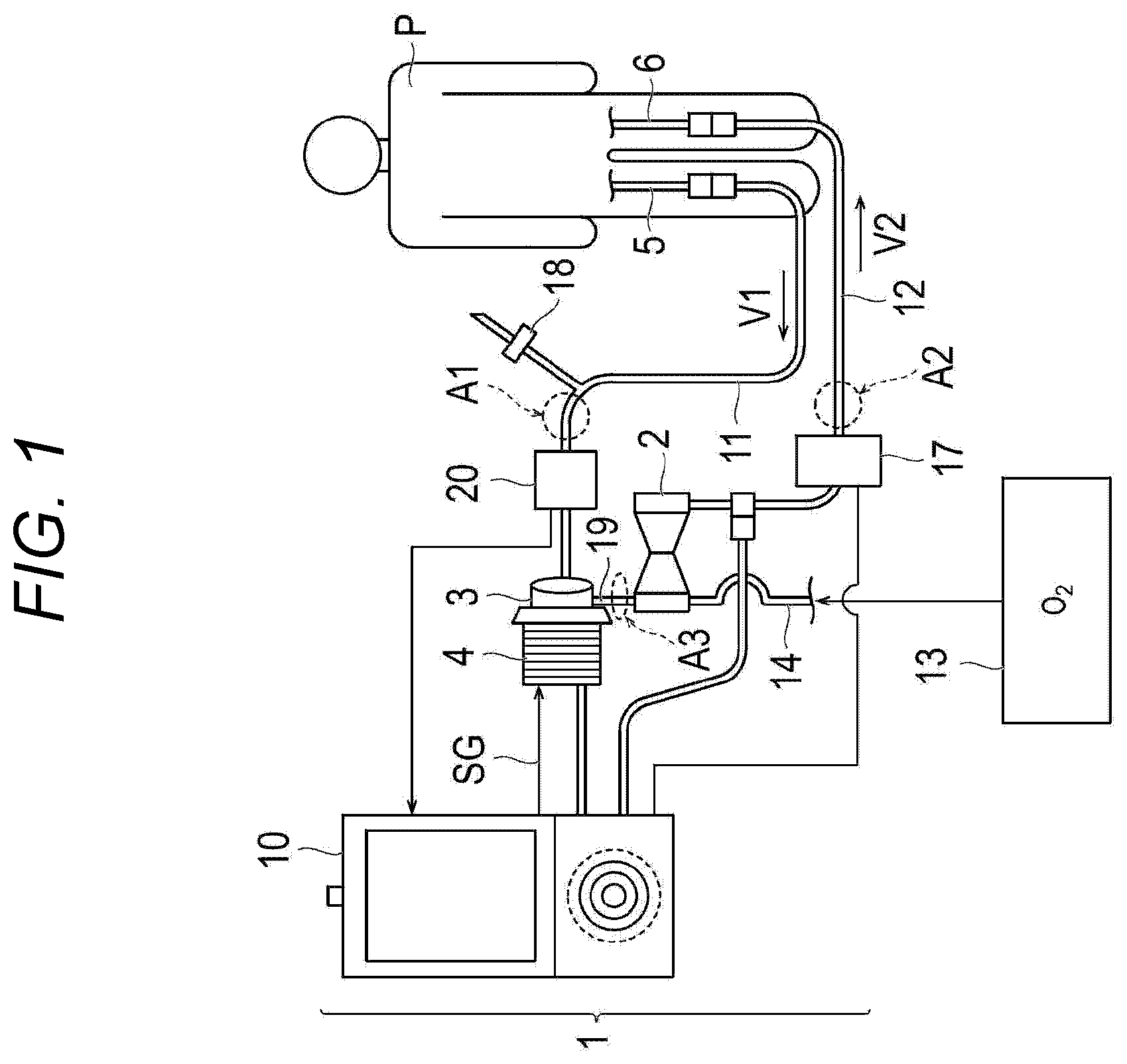 Patent US12472298 Figure 1 – Percutaneous catheter