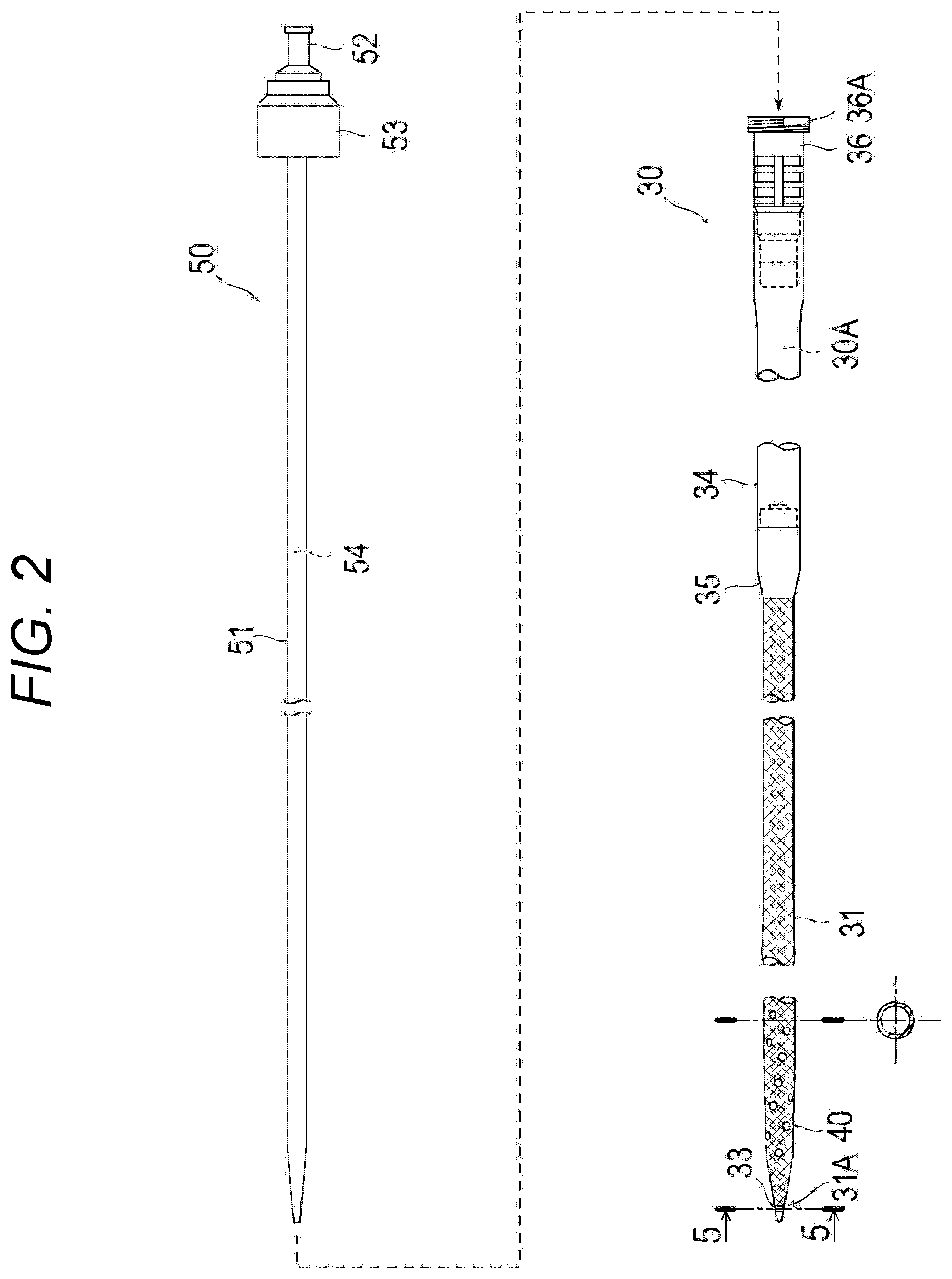 Patent US12472298 Figure 2 – Percutaneous catheter
