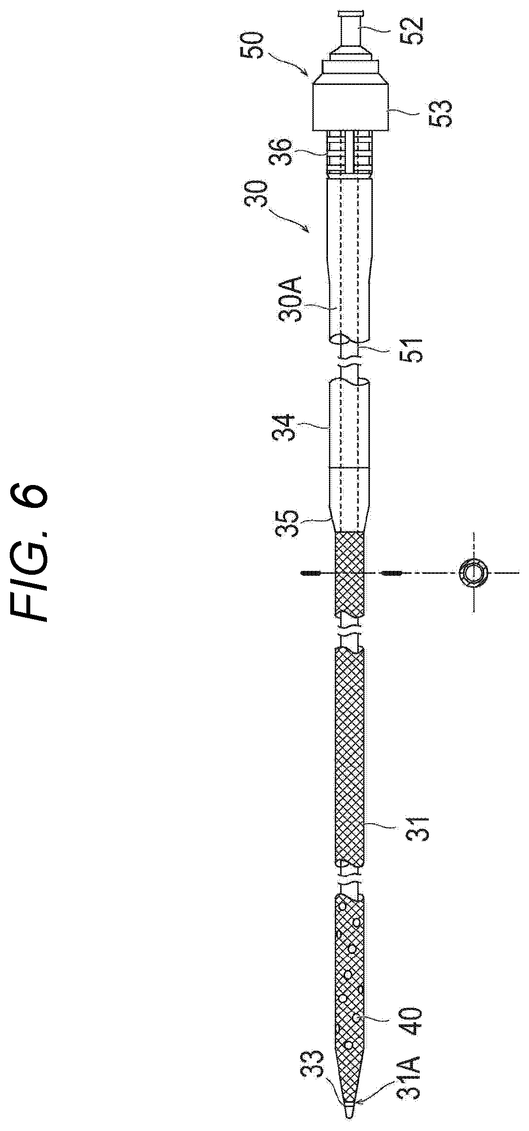 Patent US12472298 Figure 5 – Percutaneous catheter
