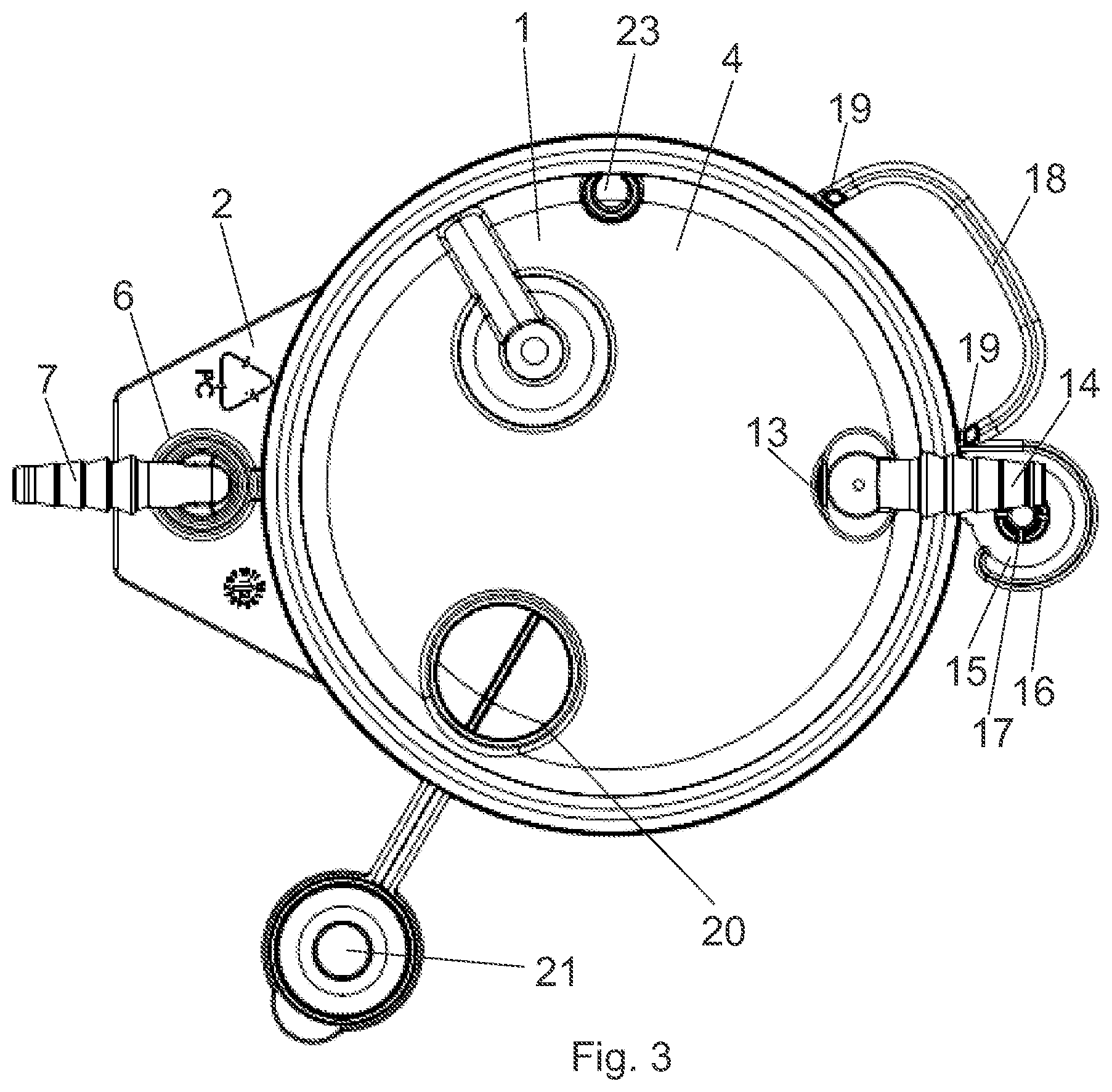 Patent US12472300 Figure 3 – Suction bag for medical or surgical use, and suction bag arrangement