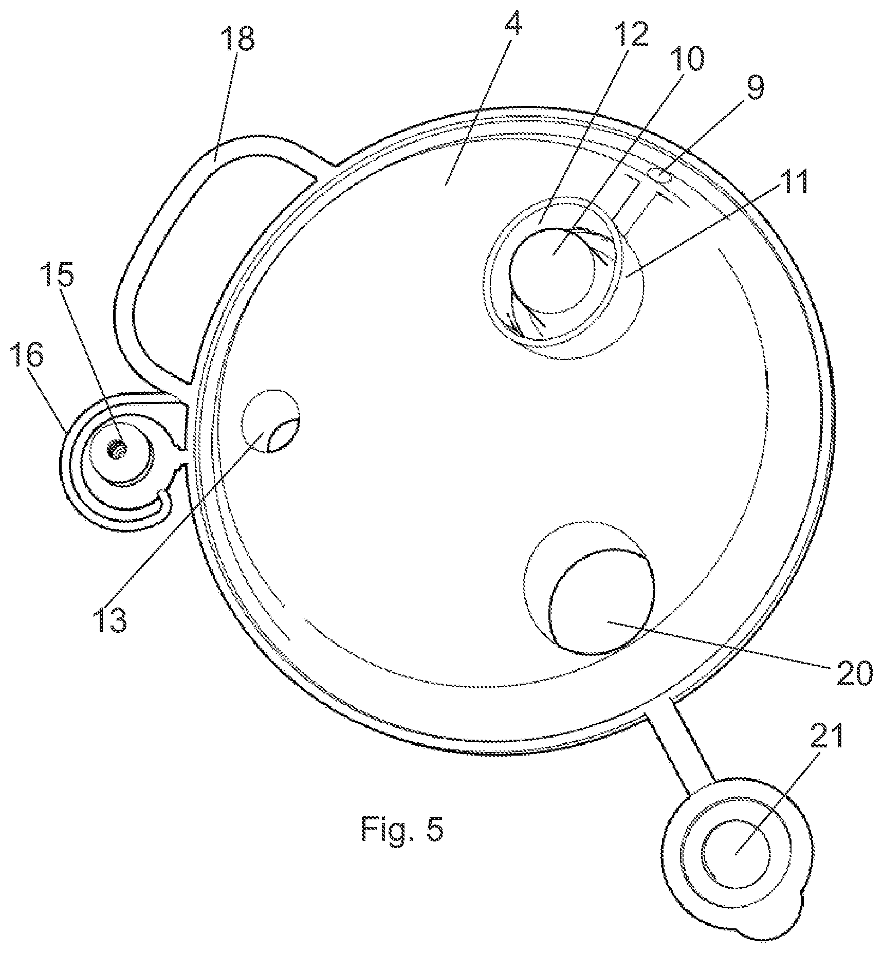 Patent US12472300 Figure 5 – Suction bag for medical or surgical use, and suction bag arrangement