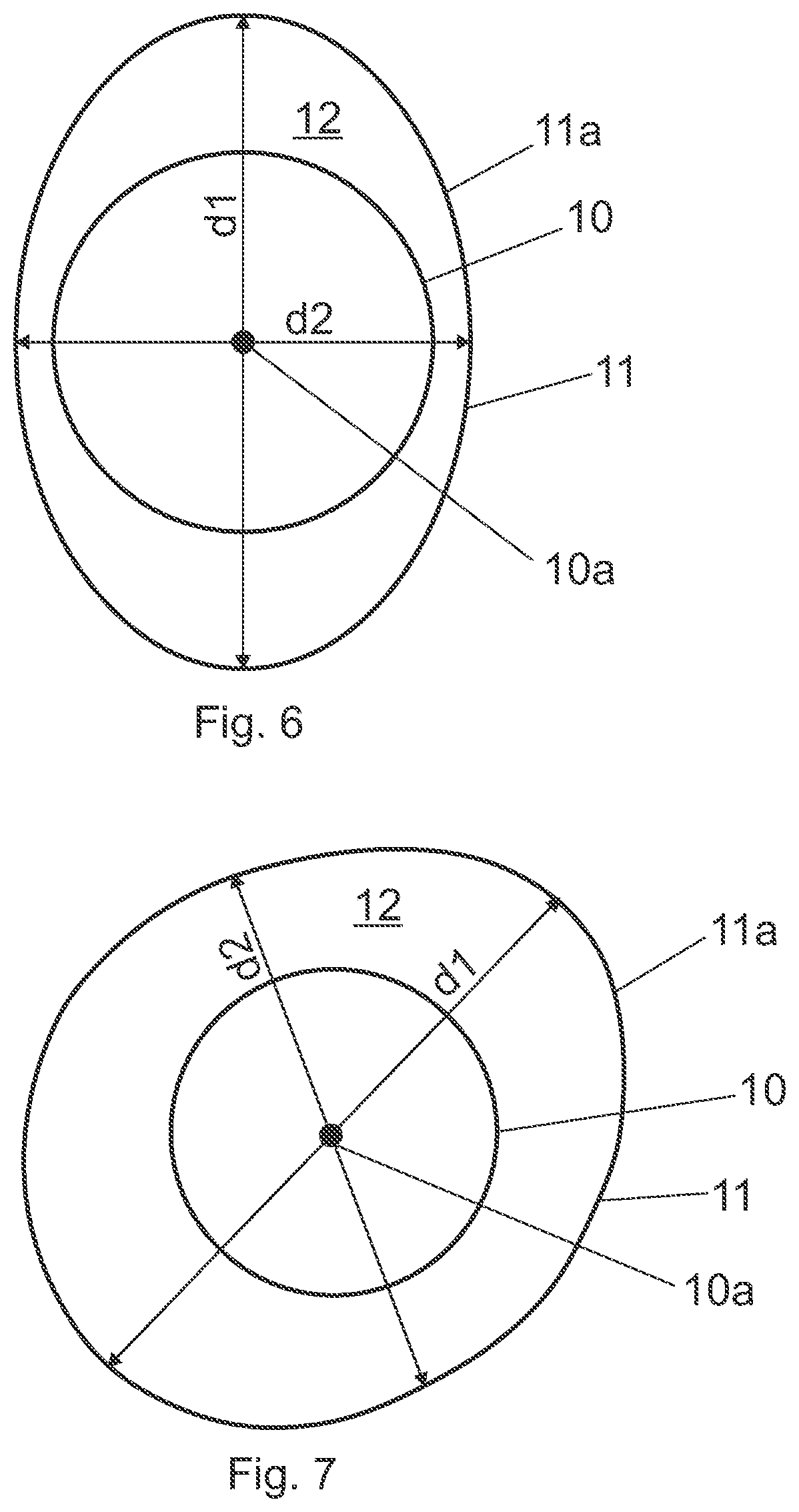 Patent US12472300 Figure 6 – Suction bag for medical or surgical use, and suction bag arrangement