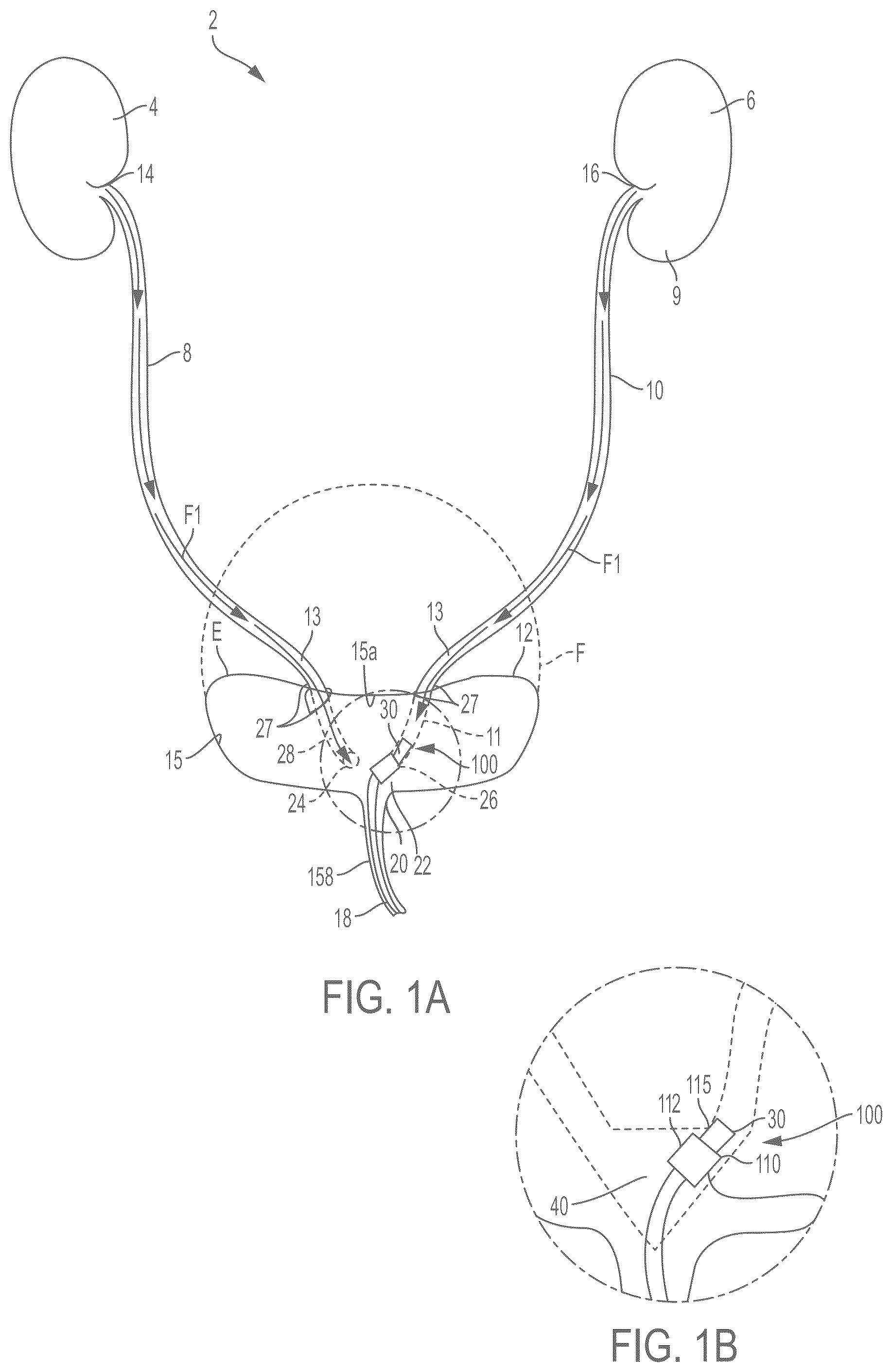 Patent US12472301 Figure 1 – Negative pressure therapy system and methods