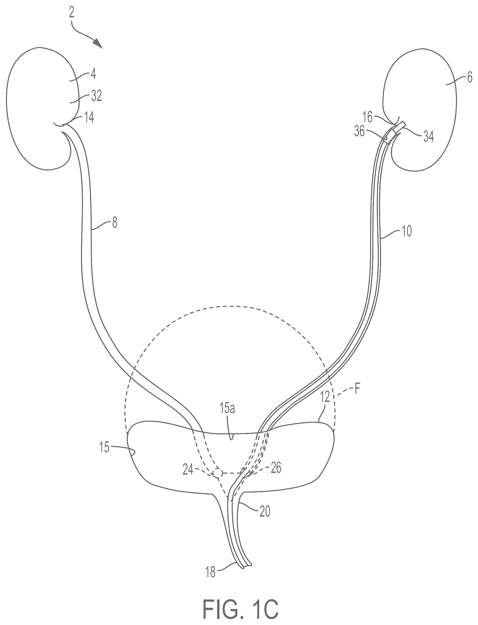 Patent US12472301 Figure 2 – Negative pressure therapy system and methods