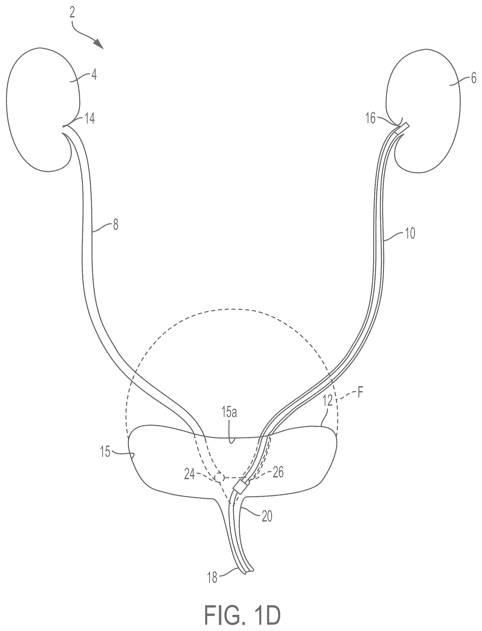 Patent US12472301 Figure 3 – Negative pressure therapy system and methods