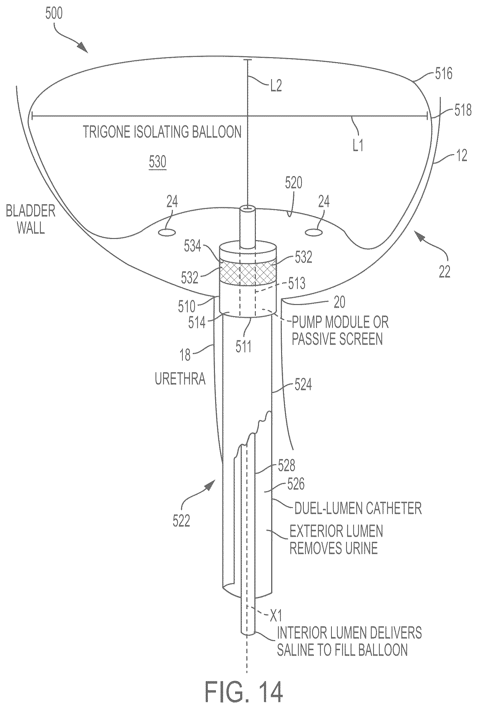 Patent US12472301 Figure 13 – Negative pressure therapy system and methods