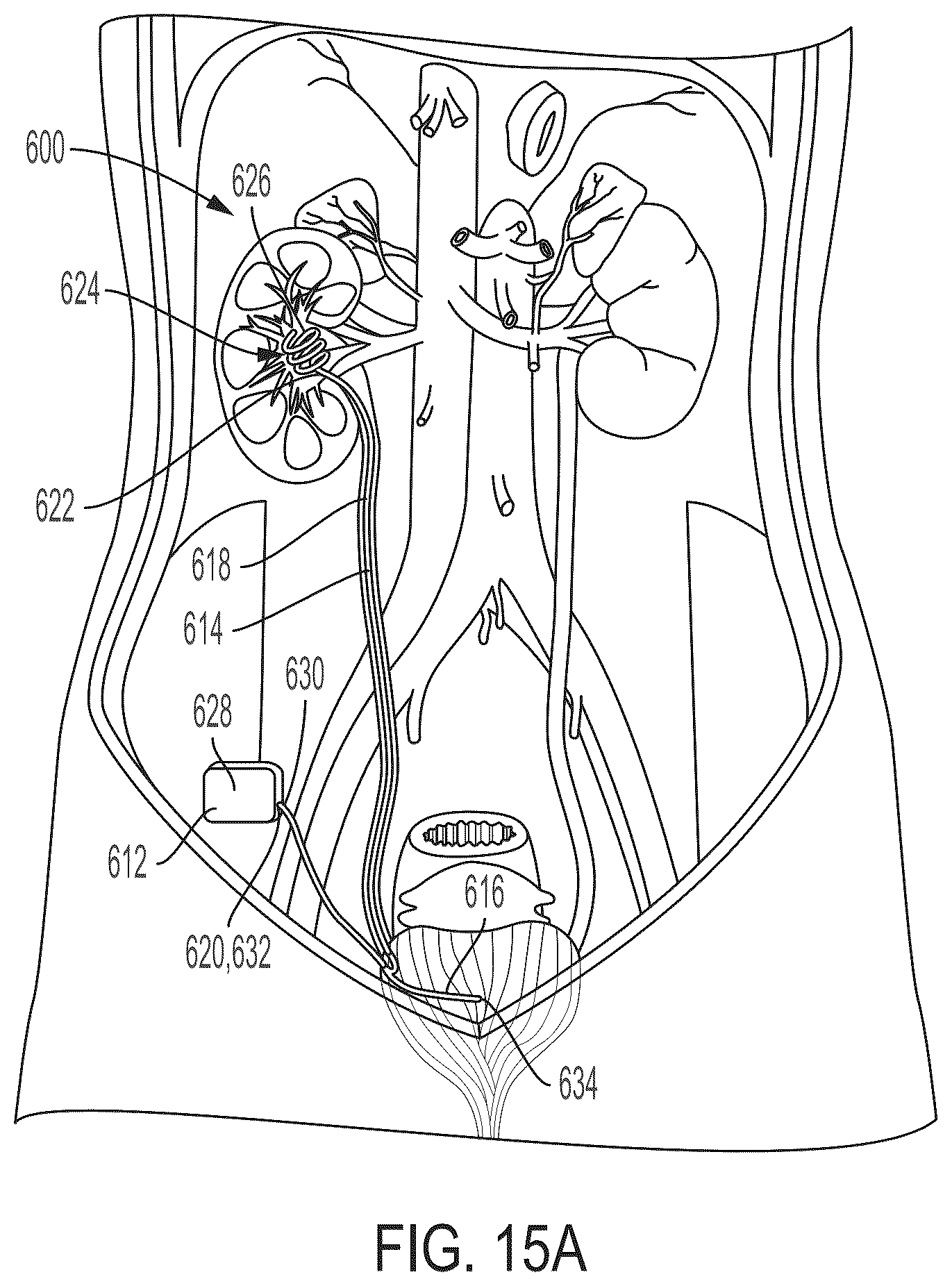 Patent US12472301 Figure 14 – Negative pressure therapy system and methods