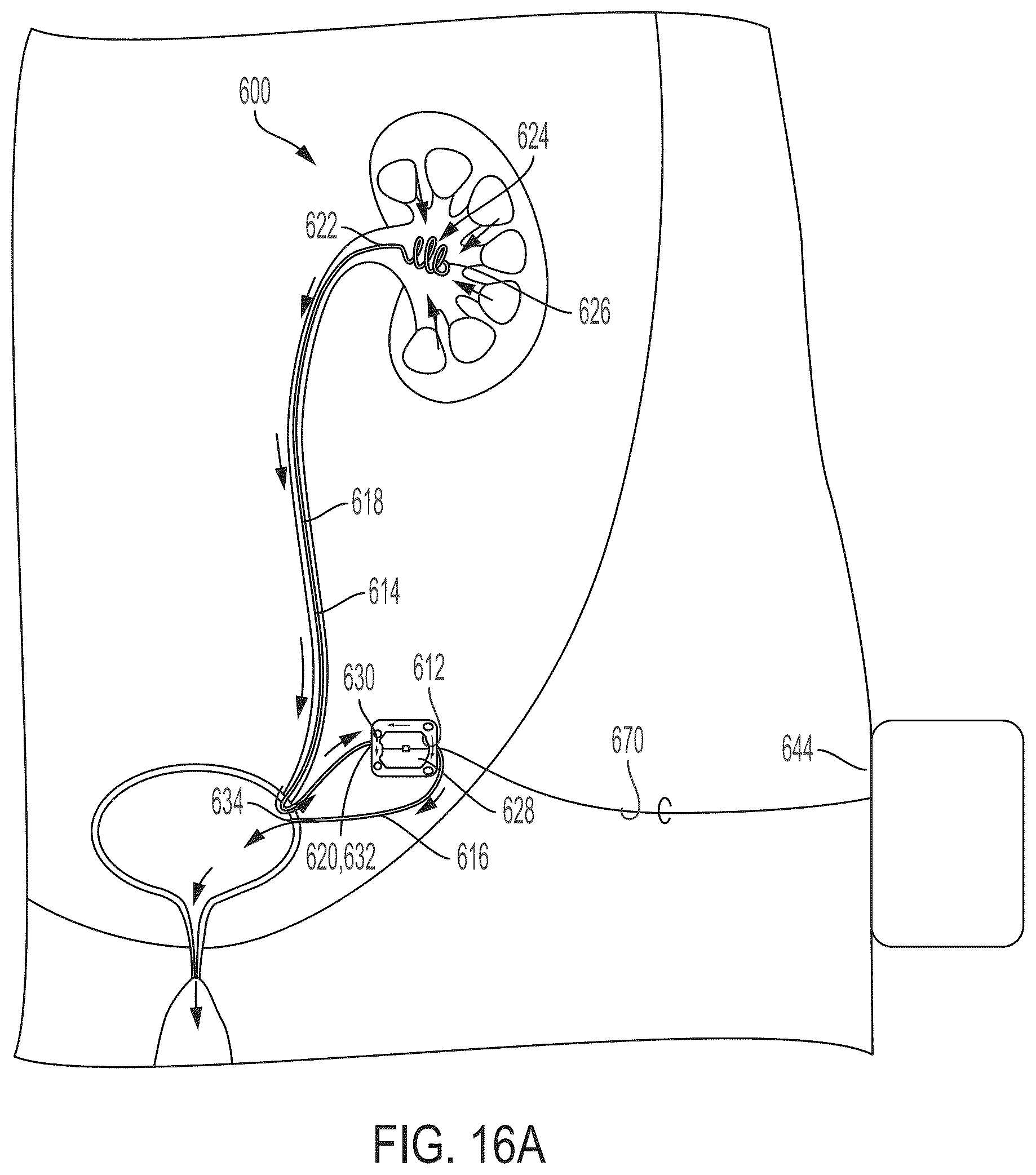 Patent US12472301 Figure 18 – Negative pressure therapy system and methods