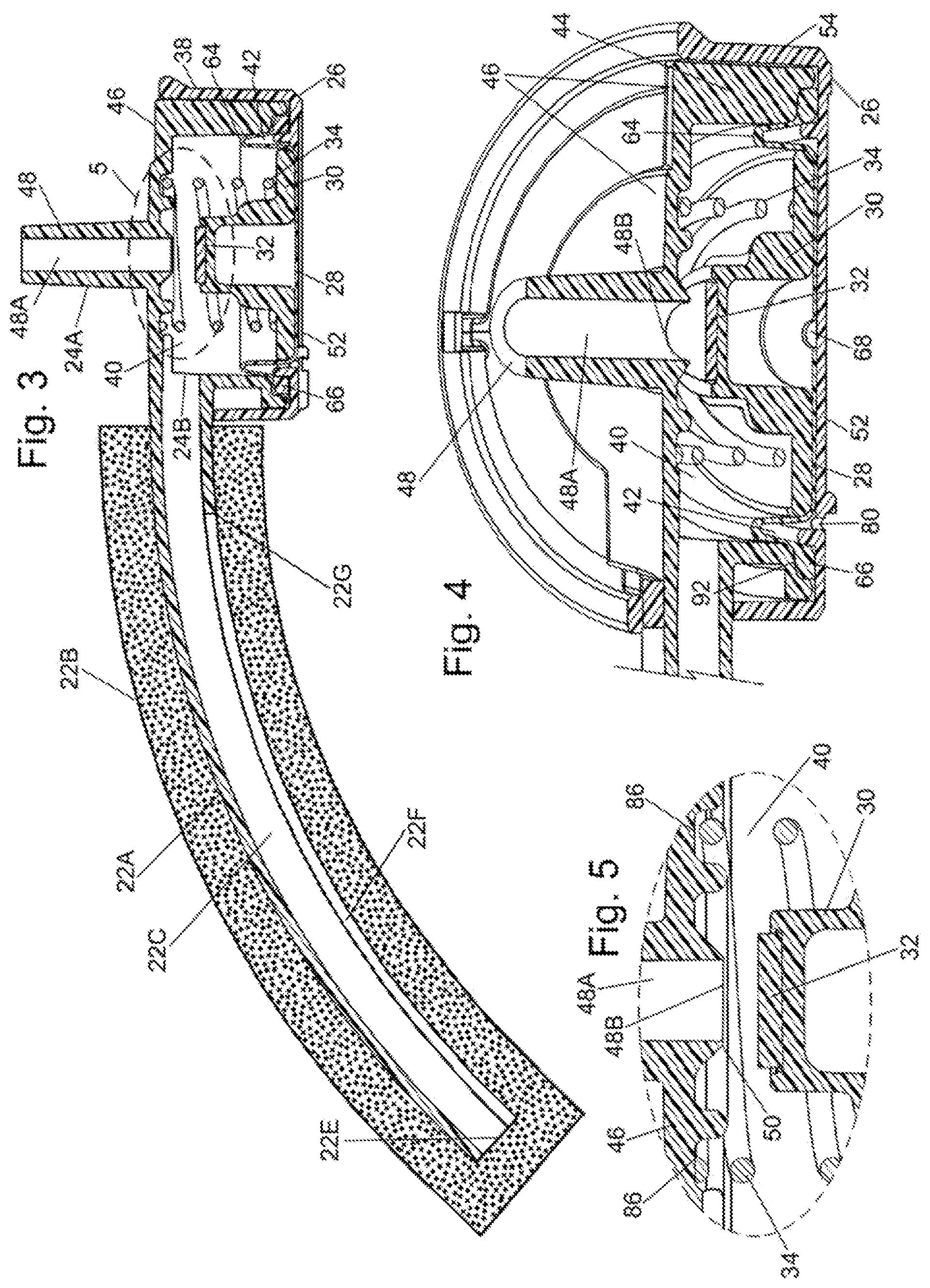 Patent US12472302 Figure 2 – External female catheter system and method of use